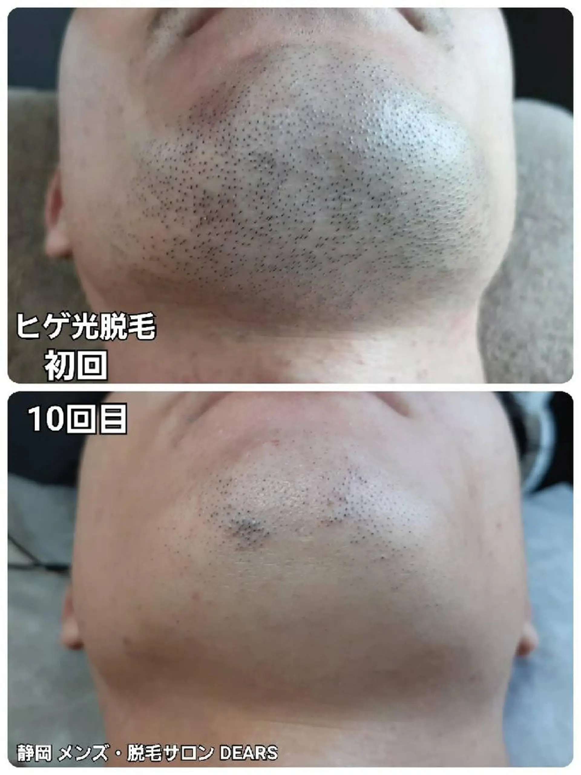 メンズ メンズ・脱毛サロン DEARS所属・山村幸久　メンズ脱毛 ディアーズのエステ・リラクイメージ