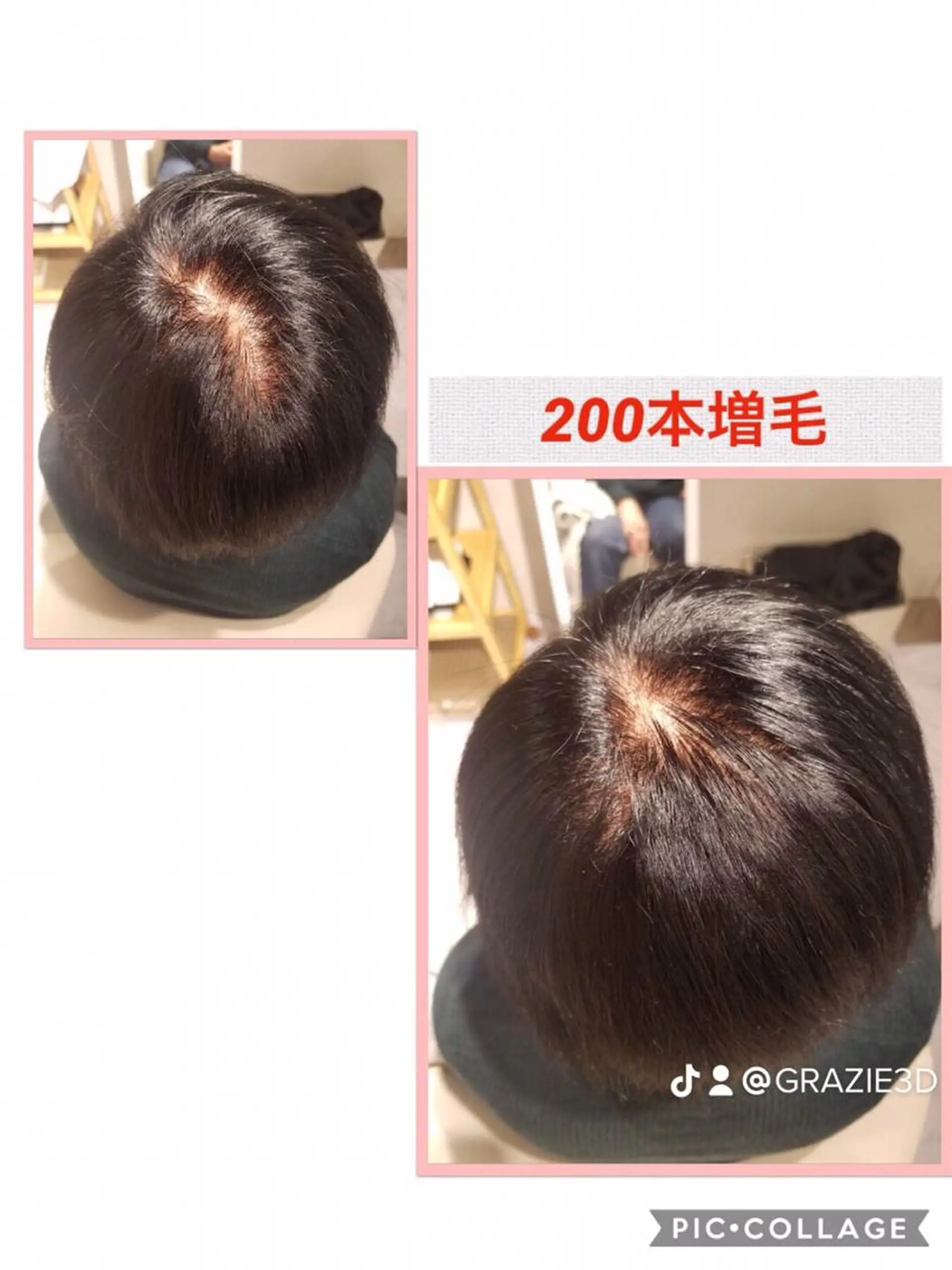 ショート エクステ 頭髪学院所属・髪の毛増やしま専科 頭髪学院のその他イメージ