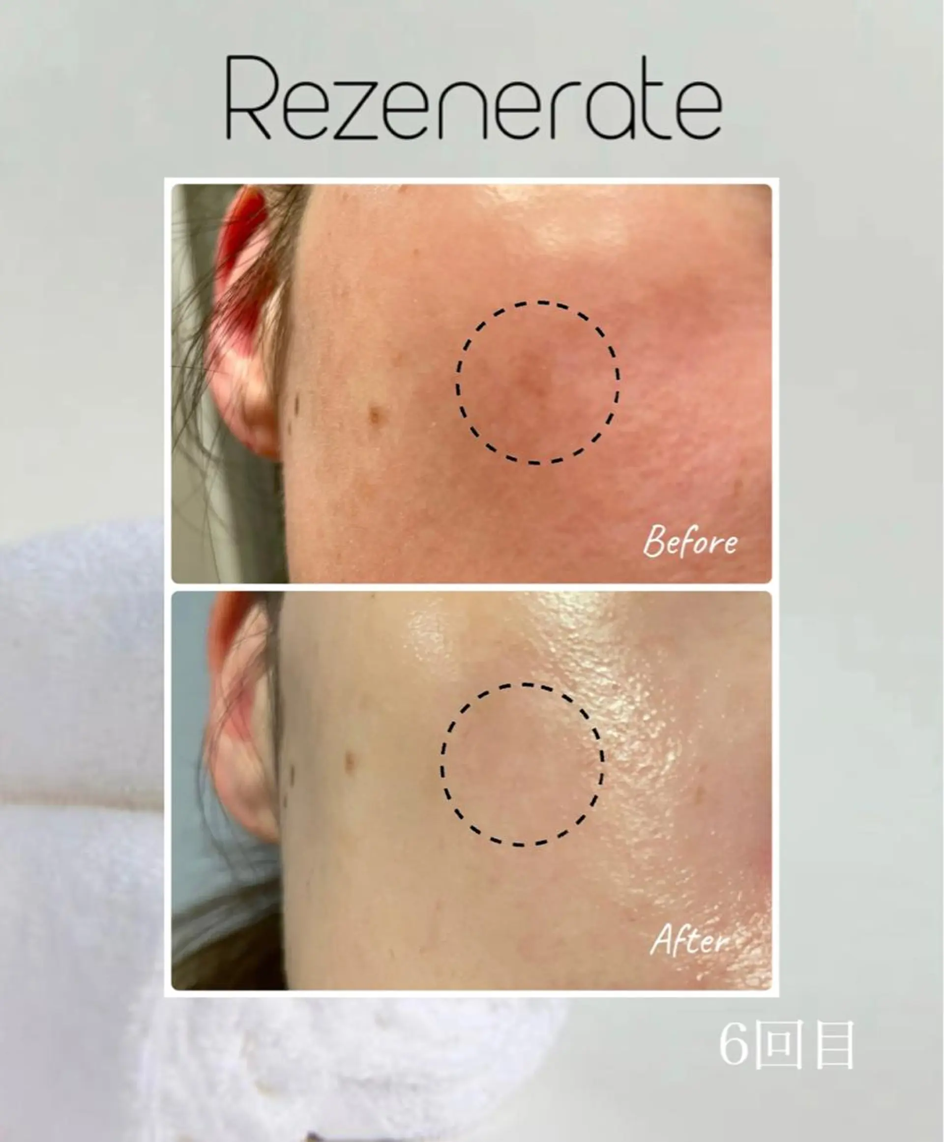 エステ Ailes de Ange　MARIのエステ・リラクイメージ