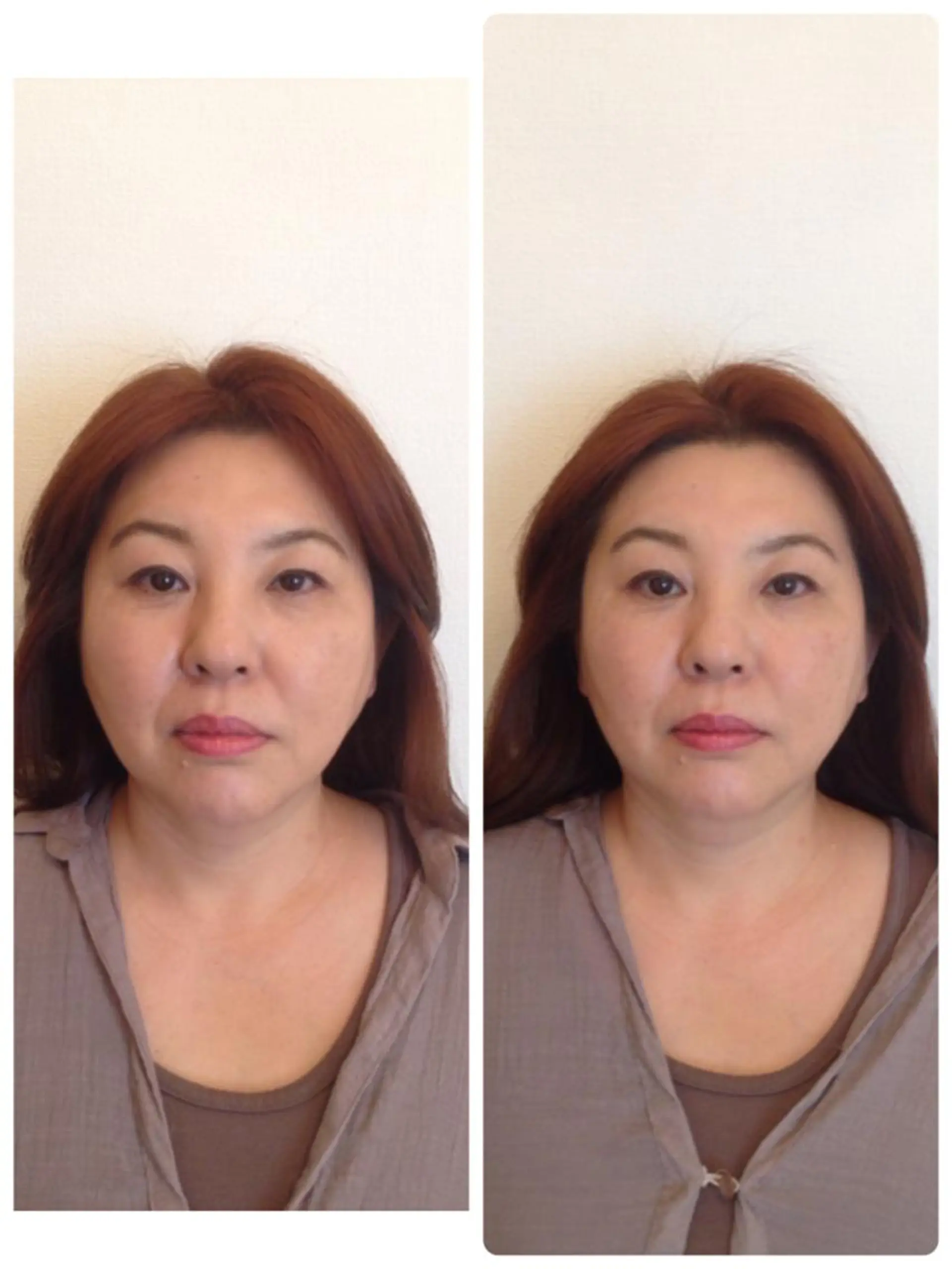 町田・鶴川 小顔矯正 /鈴木友実のその他イメージ