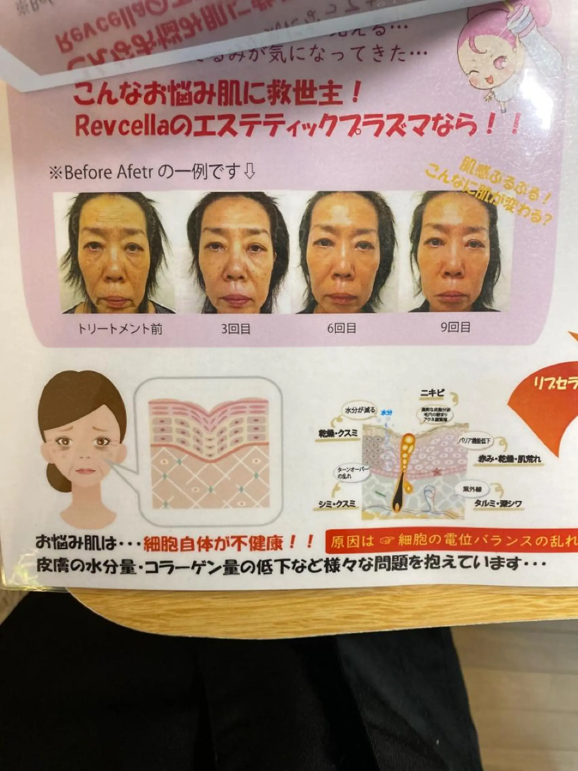 Meetite 小林のエステ・リラクイメージ