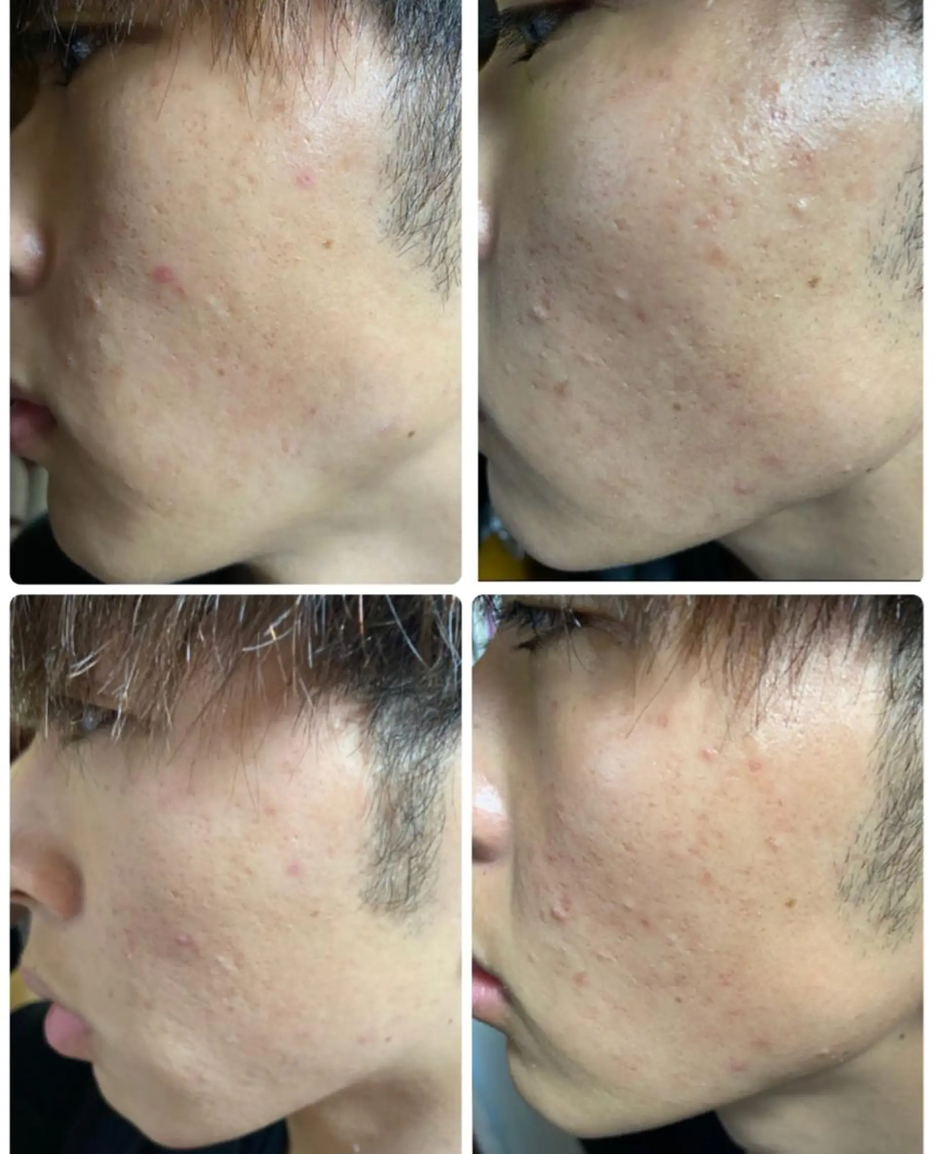 ARONA(アローナ)所属・ARONA ♡のエステ・リラクイメージ