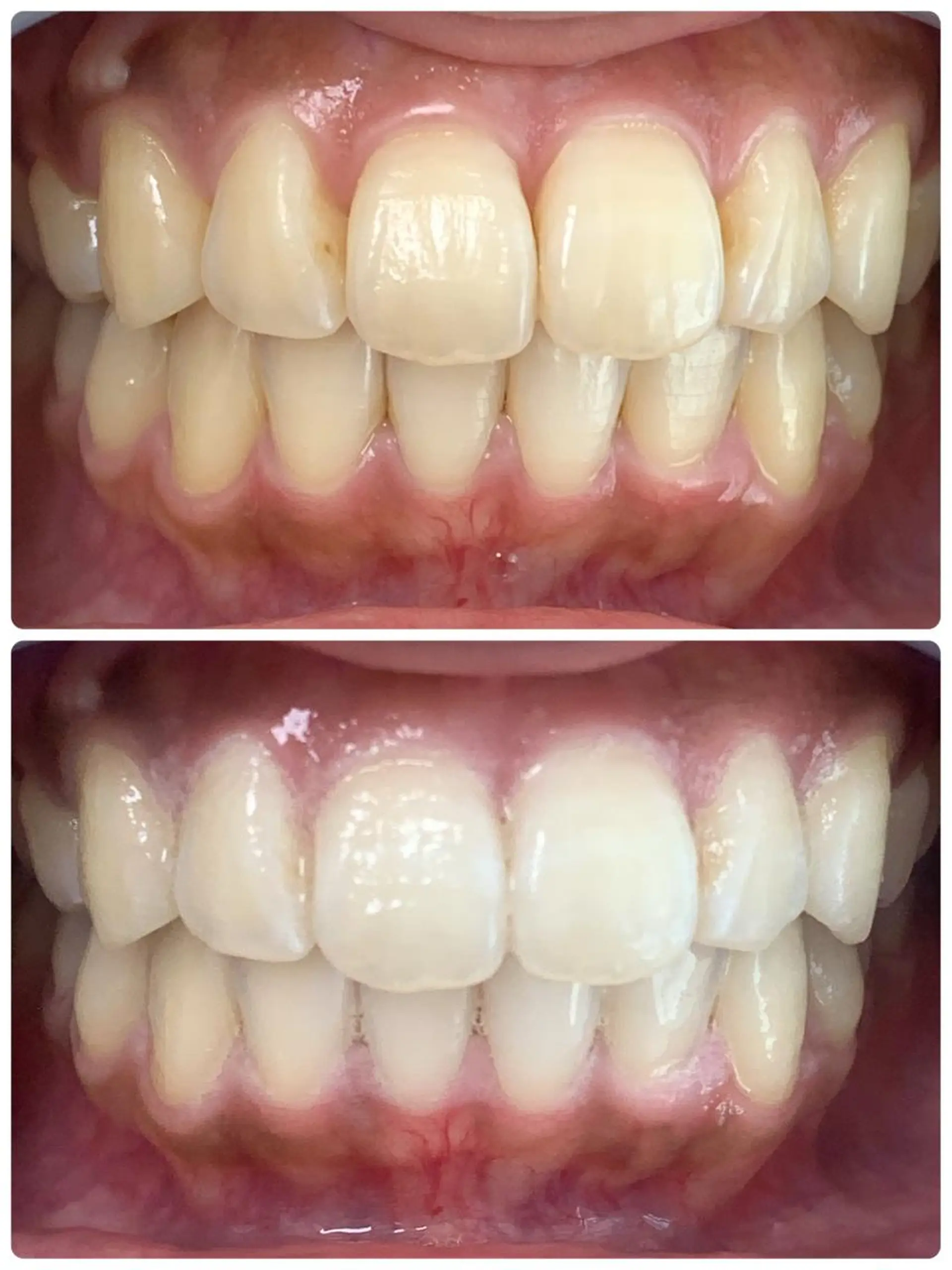 LOVE ホワイトニング戸辺のその他イメージ