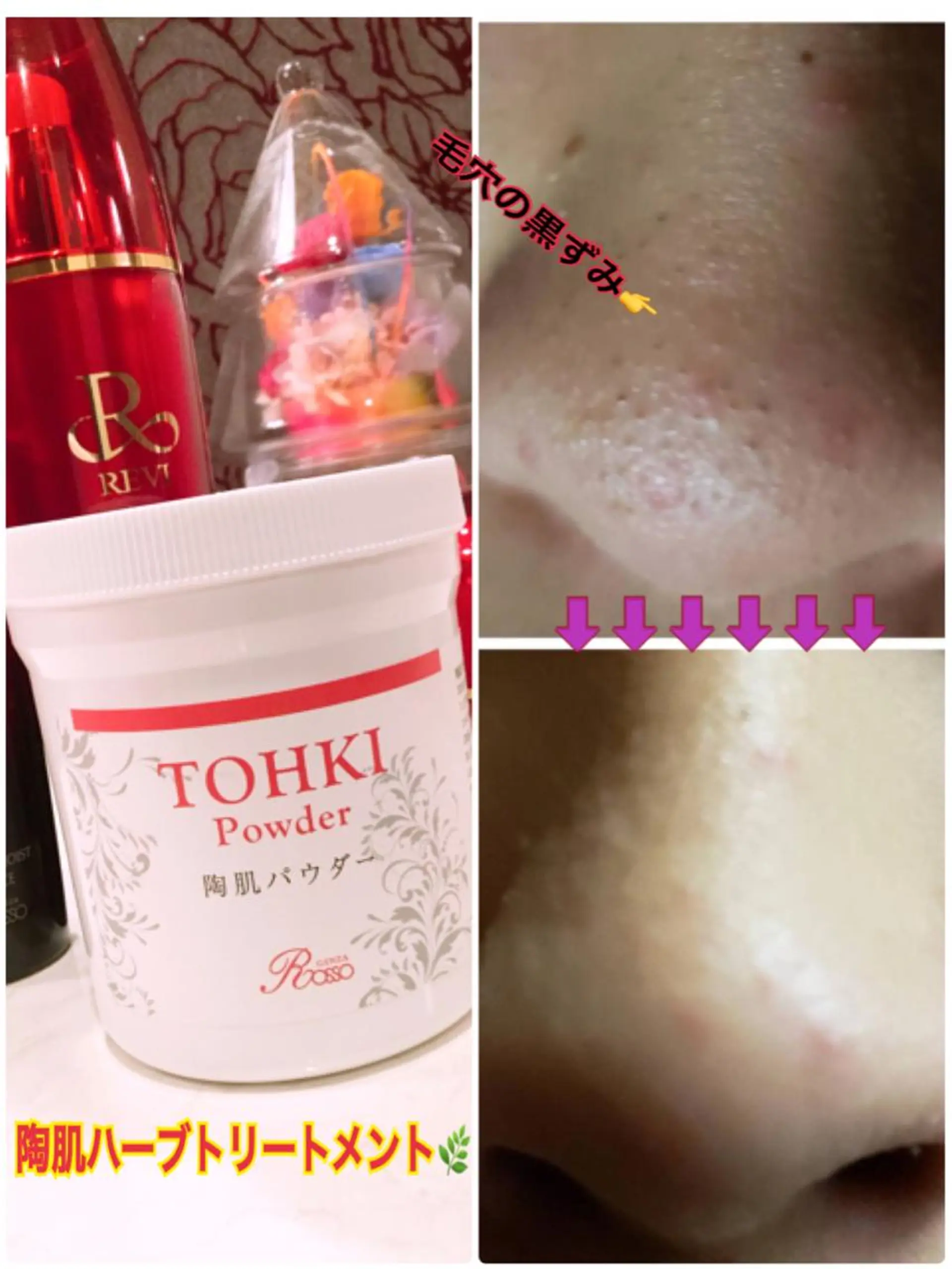 エステ 【リベルハーブピーリング認定店】敏感肌・美白脱毛専門店Dione立川店所属・Dione 立川店のエステ・リラクイメージ