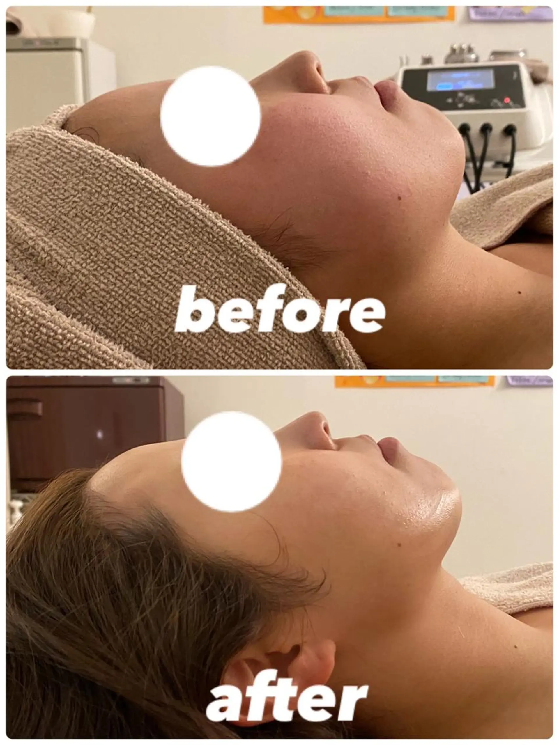 毛穴&ニキビケア 専門ルナボーテ渋谷のエステ・リラクイメージ