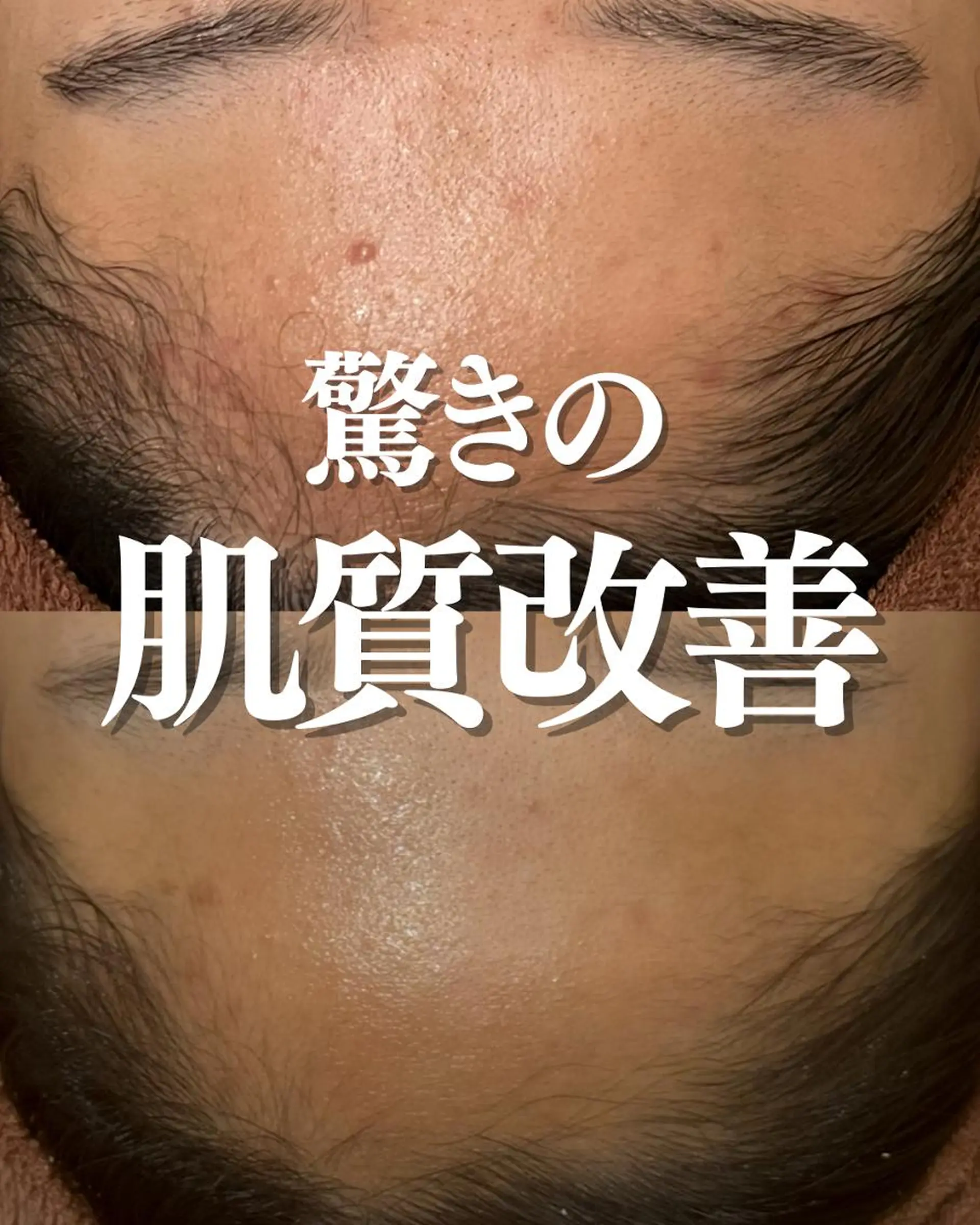 ダウンタイムなし🌷 優しい肌質改善のエステ・リラクイメージ