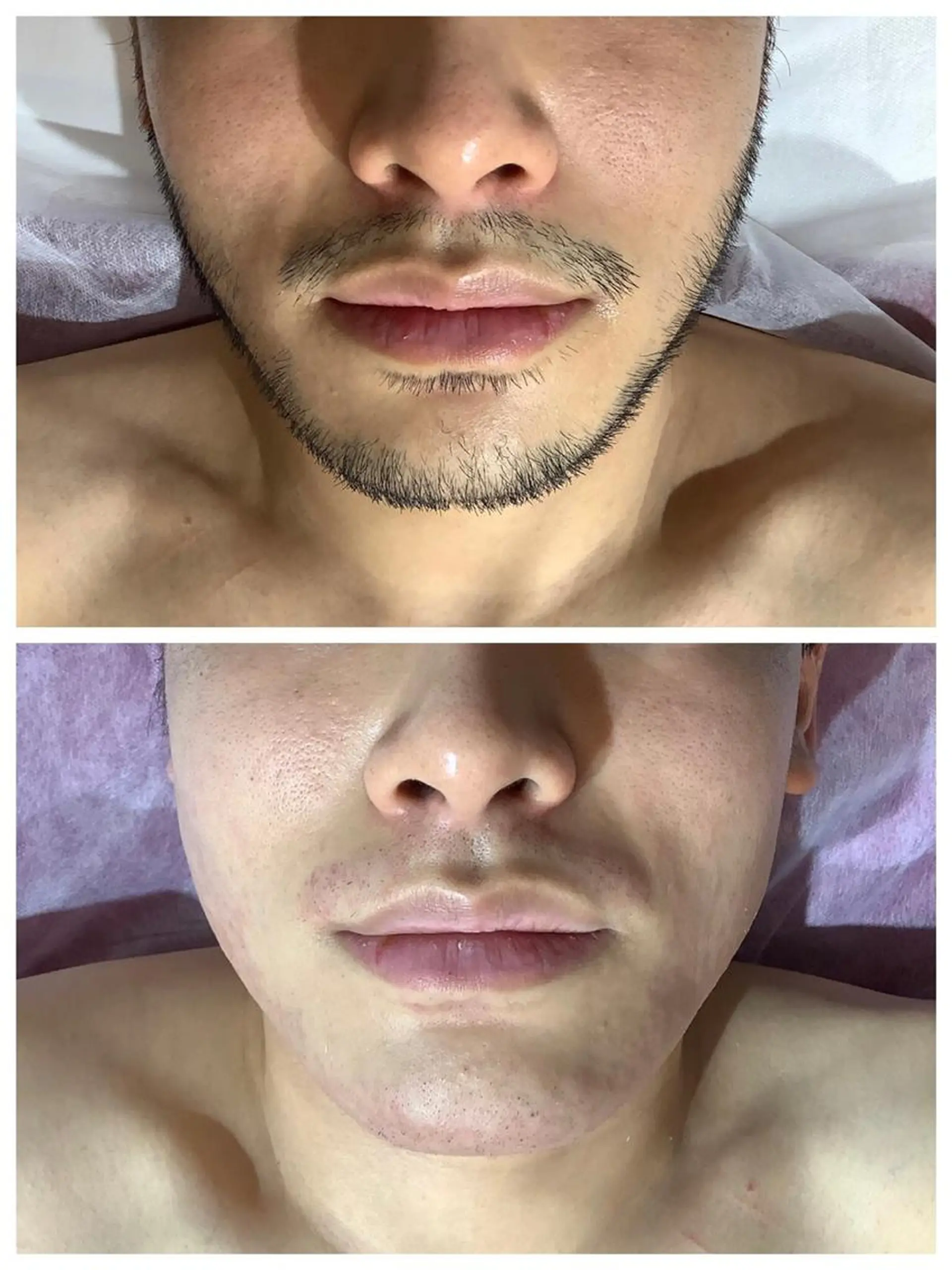 メンズ 脱毛 HIKARI a.k.a 神童♡のエステ・リラクイメージ