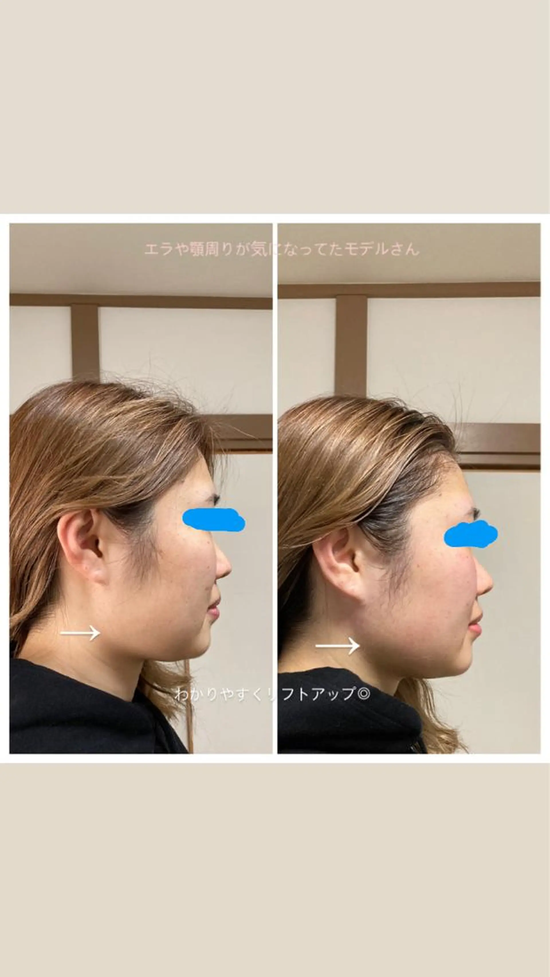 ボディケア 元住吉 SUGAのエステ・リラクイメージ