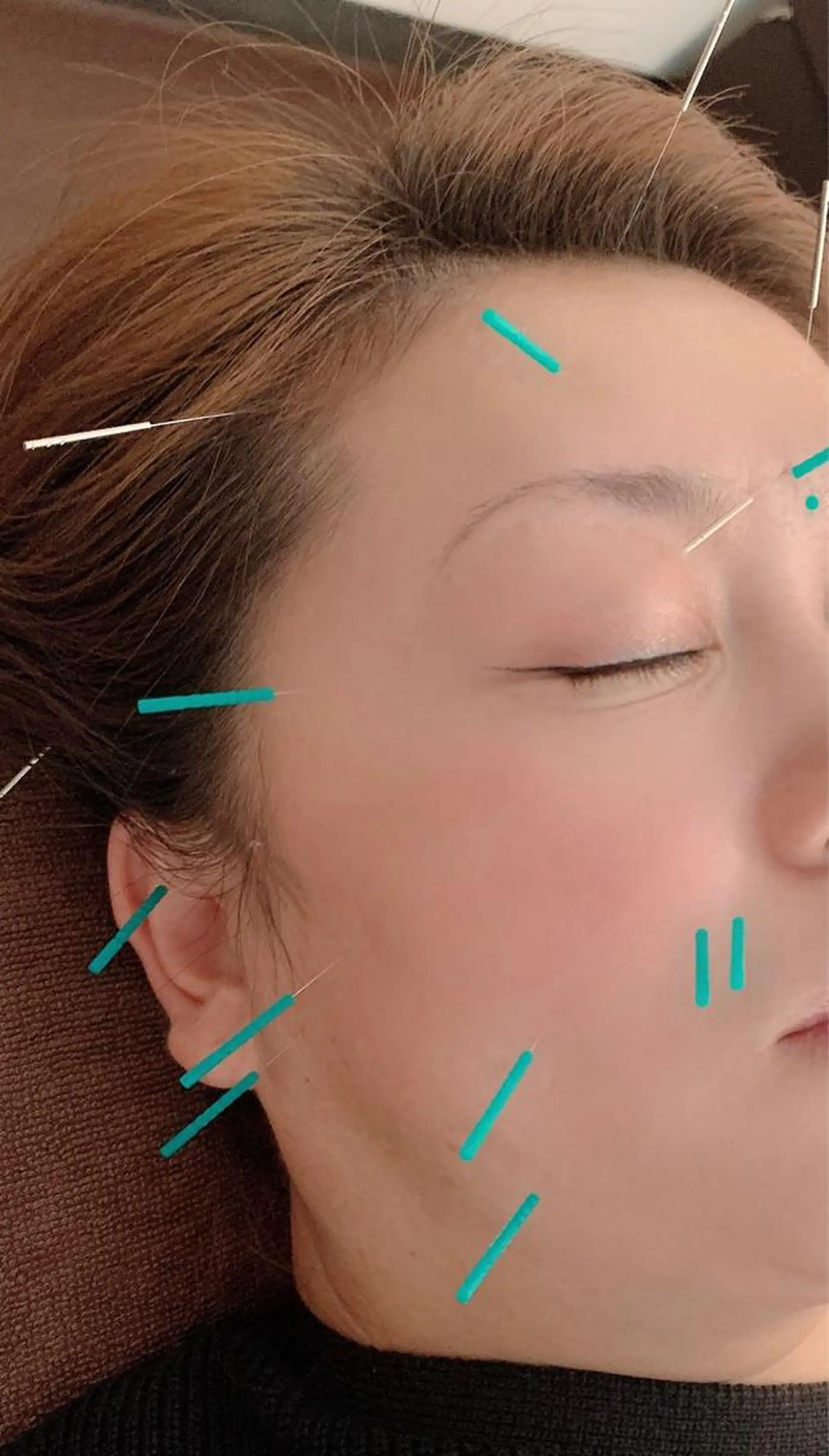 美容鍼灸イロドリ  のエステ・リラクイメージ