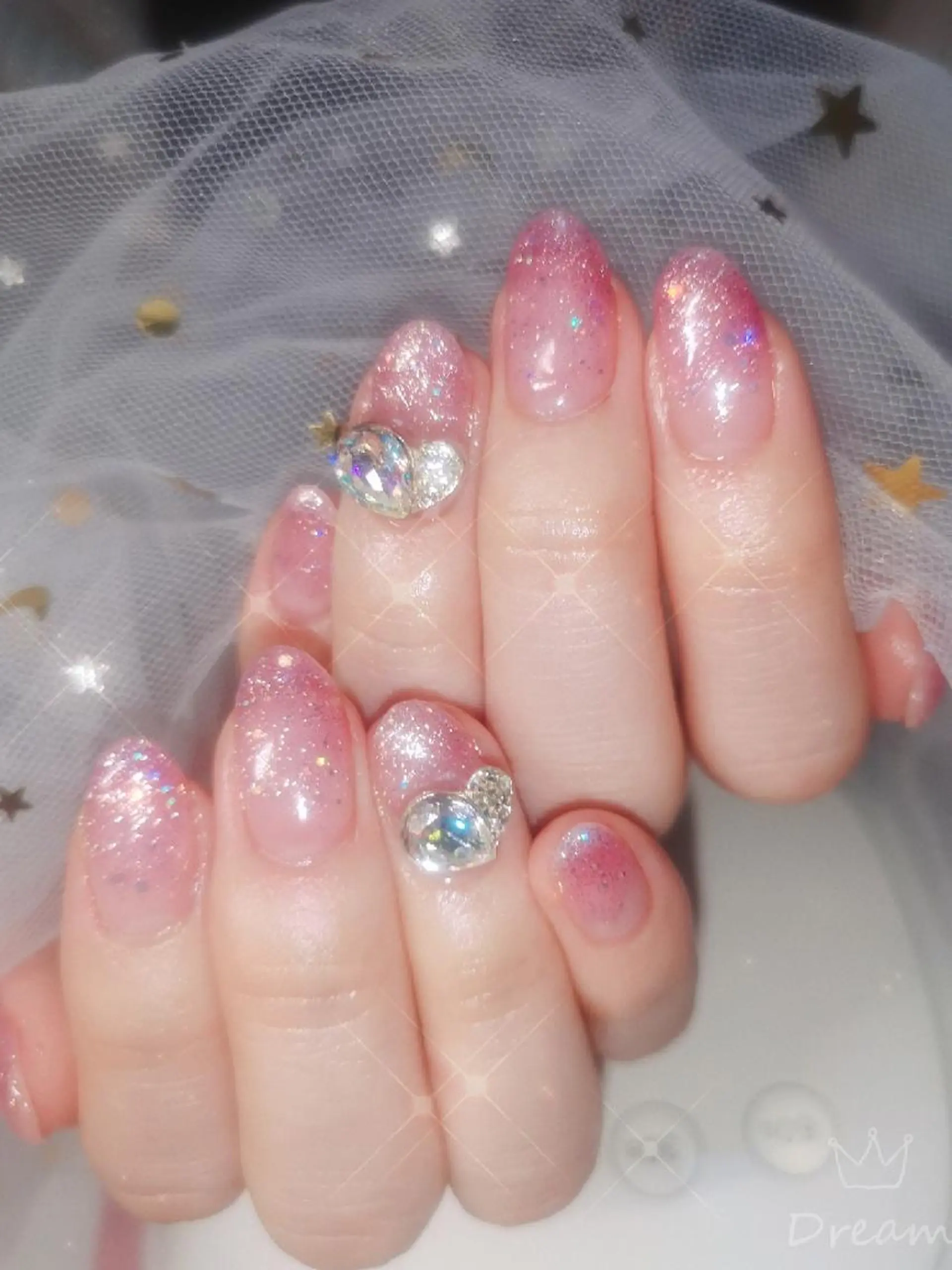 ネイル ミディアム ネイリストゆか💅 長さだし、深爪矯正のネイルデザイン