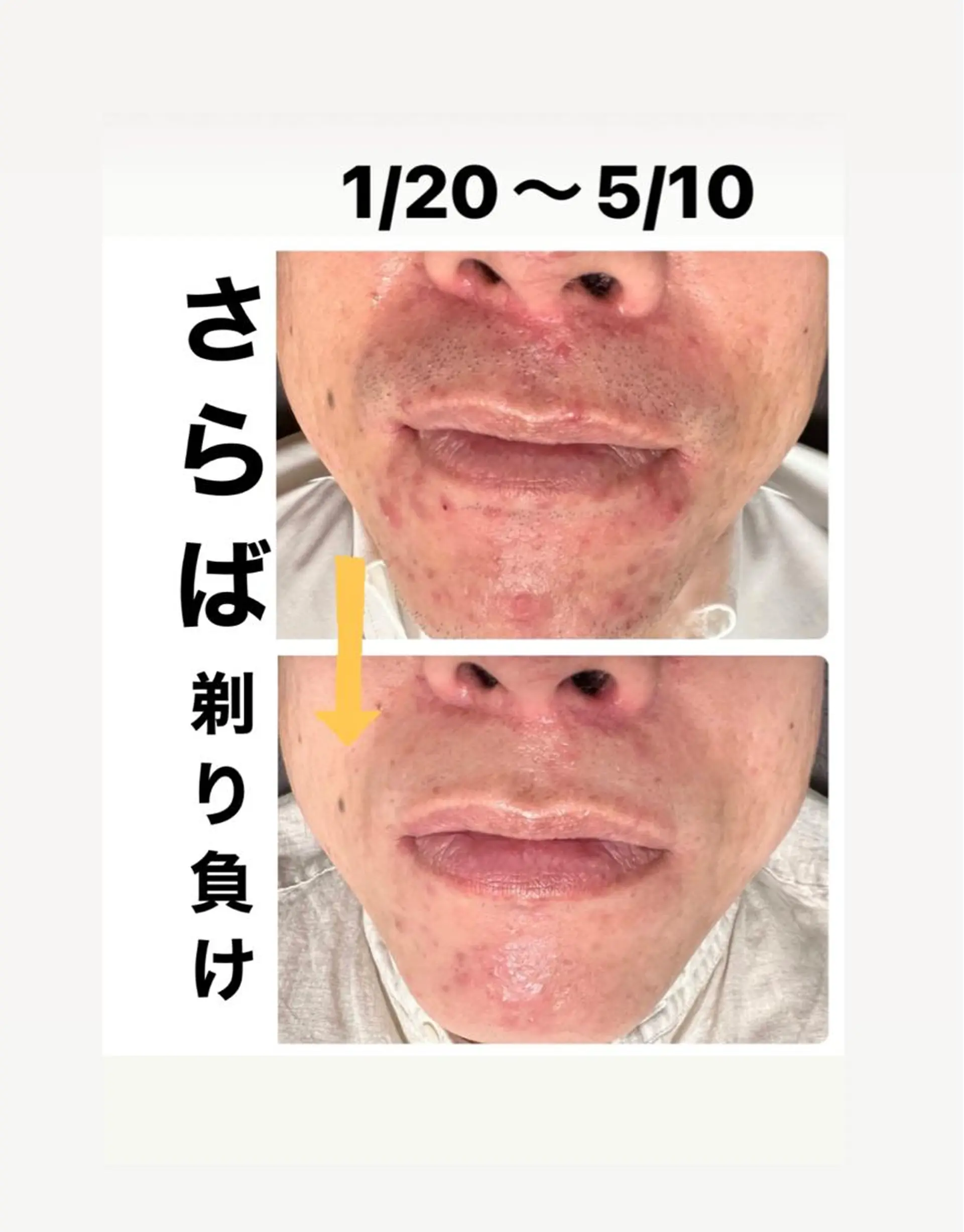 メンズ メンズハイライト 脱毛 メンズ脱毛サロン Le falcoのエステ・リラクイメージ