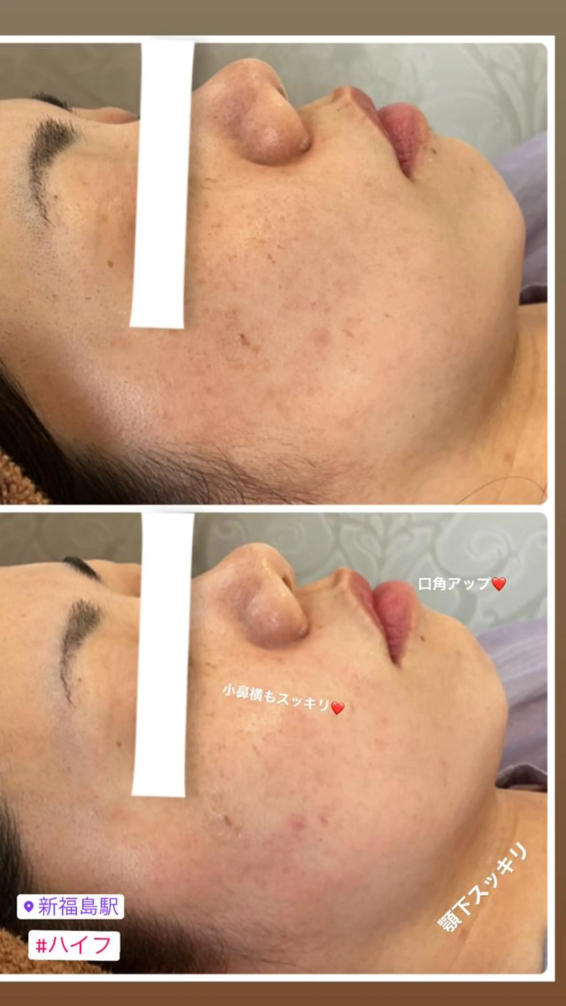 エステ リラク FLEURフェイシャ ル🫧ハーブ🌿小顔のエステ・リラクイメージ