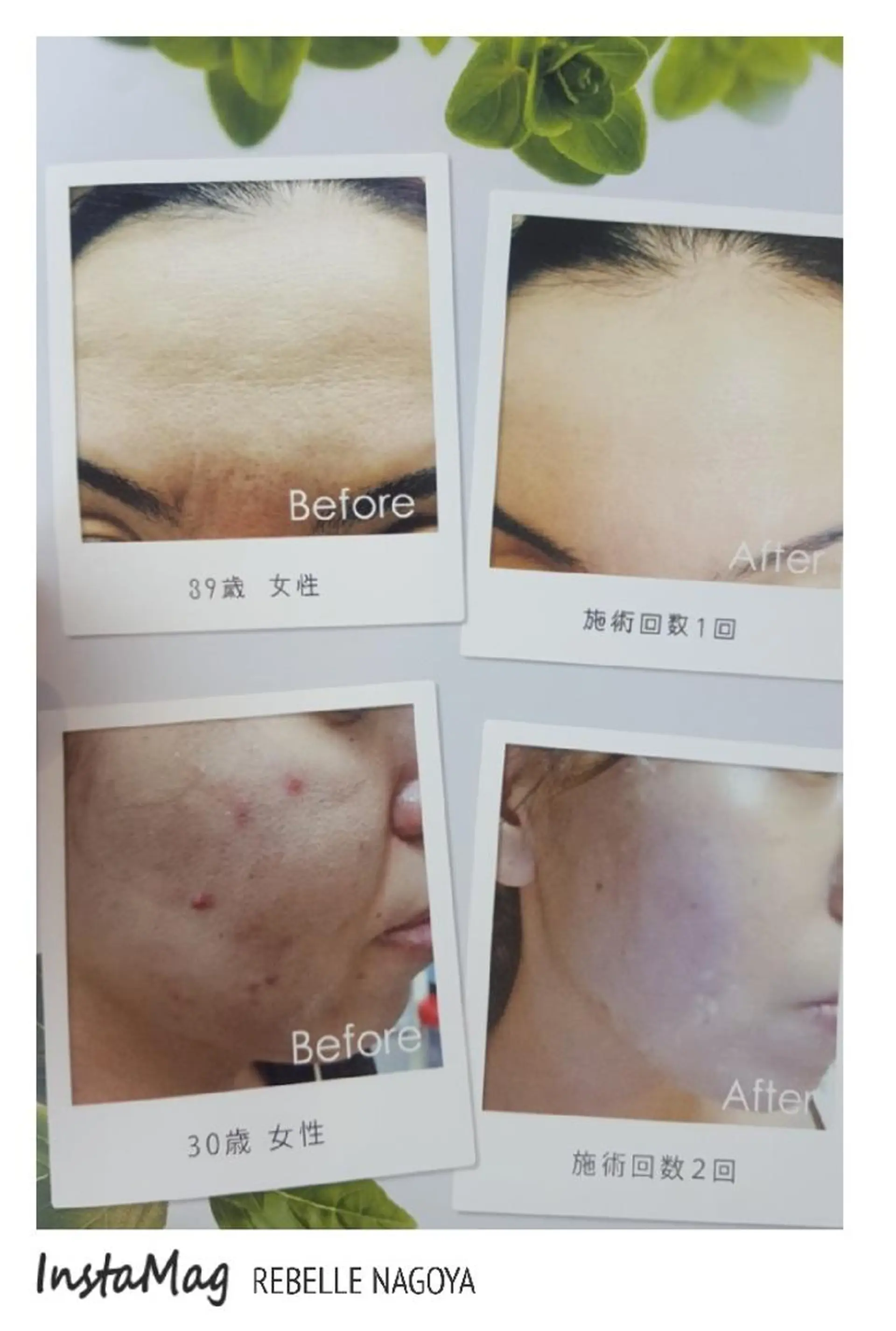 パーマ ヘアアレンジ キッズ メンズ マツエク・マツパ カラー ミディアム 次世代まつげパーマは 『リベル名古屋』のマツエク・マツパデザイン