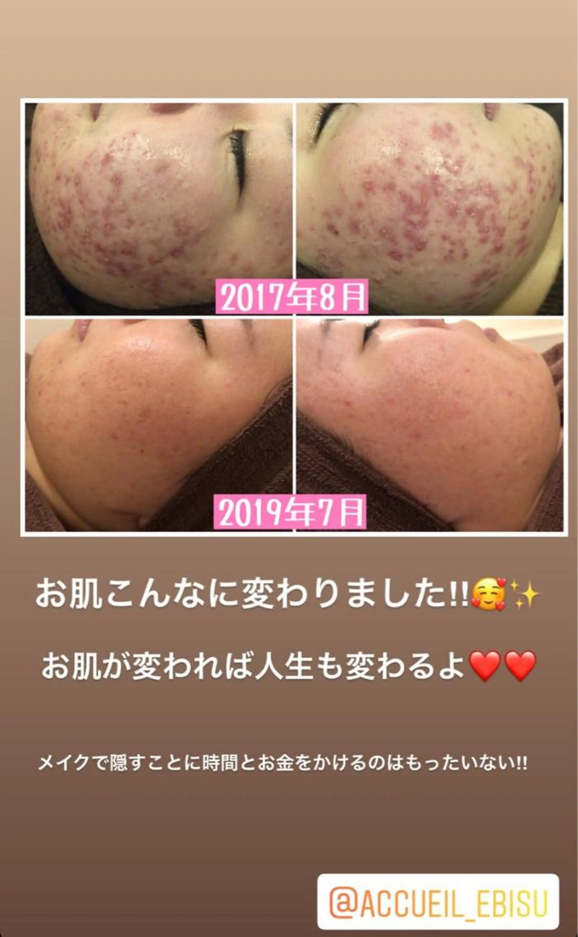 ミディアム カラー パーマ ヘアアレンジ メンズ キッズ ネイル マツエク・マツパ エステ リラク ニキビ・肌質改善専門 ♡人生が変わるサロンのエステ・リラクイメージ