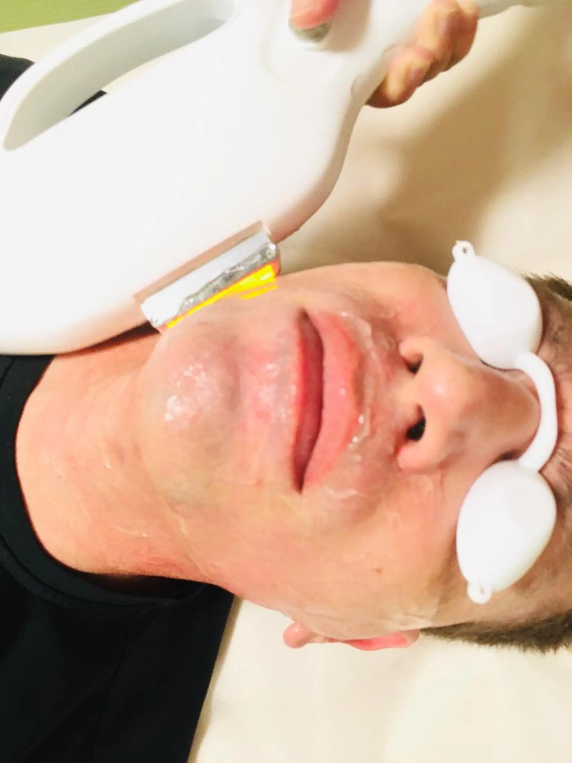 脱毛 A myのエステ・リラクイメージ