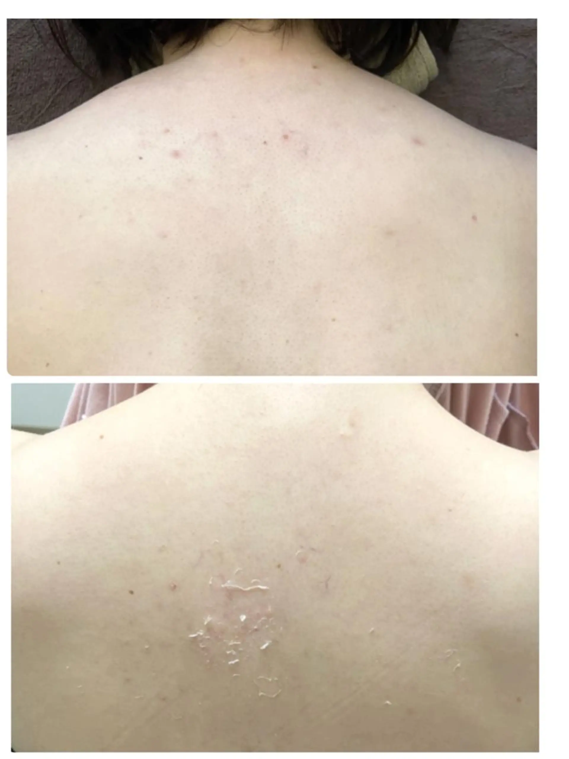 Belsia千歳烏山 ピーリング＆眉毛のエステ・リラクイメージ