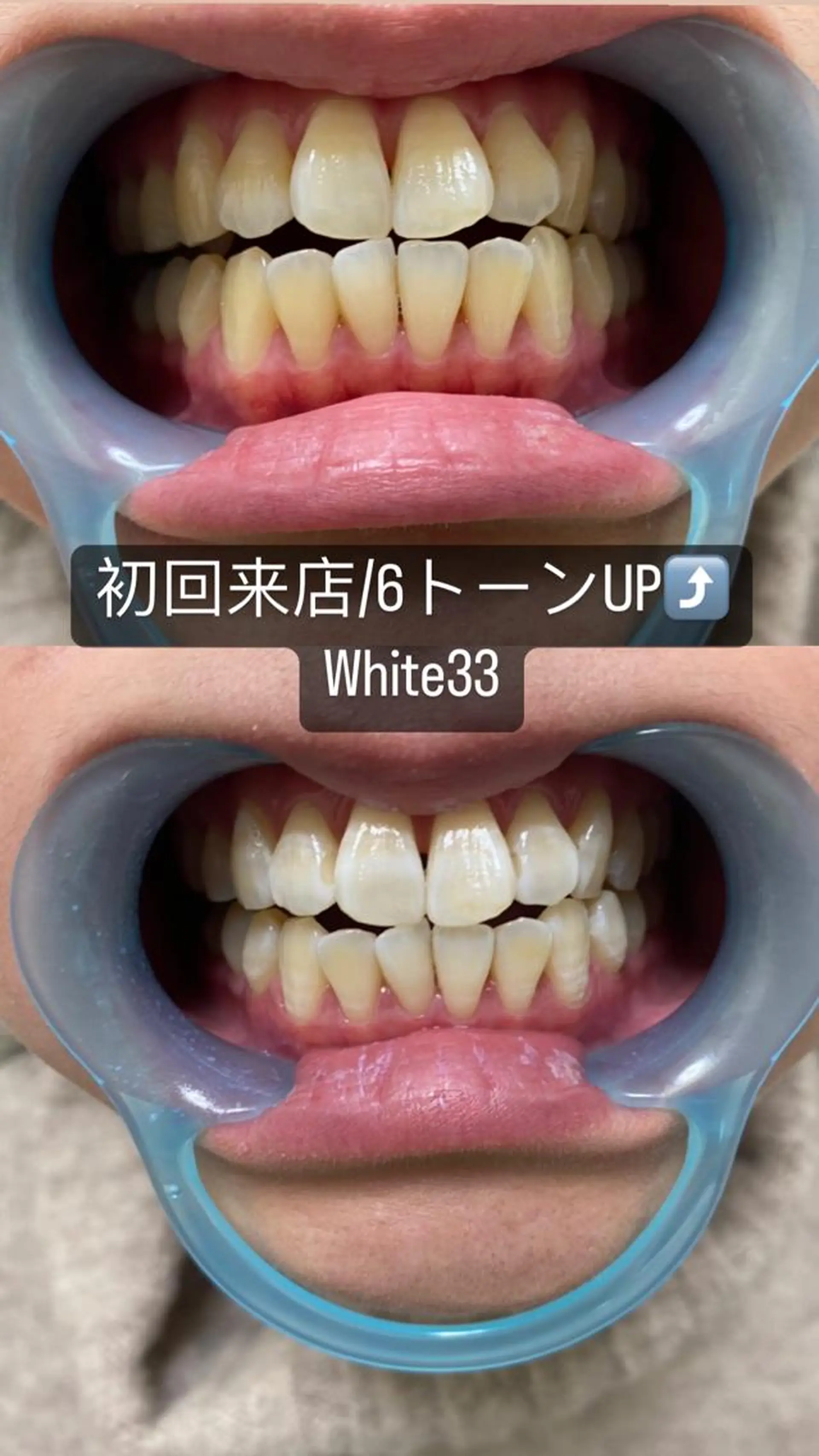 メンズ セルフホワイトニング White33大名のその他イメージ