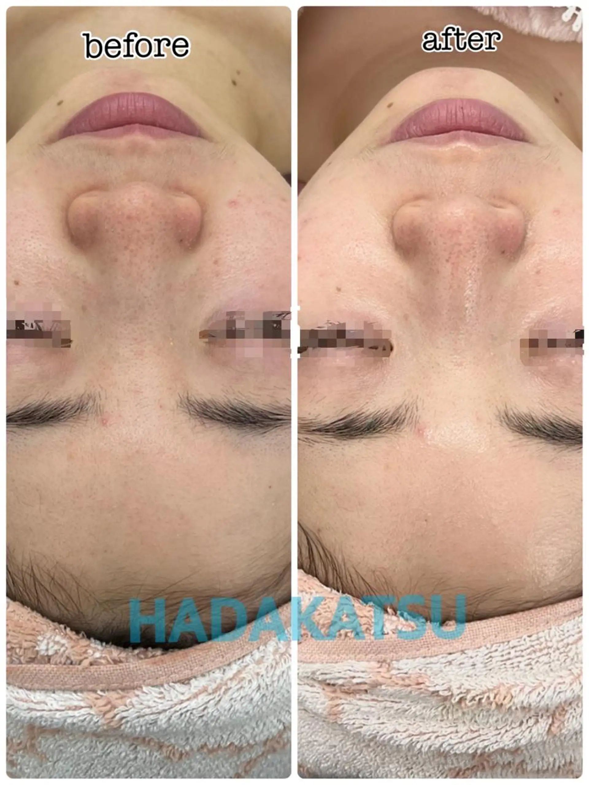 総合エステサロン 肌活のエステ・リラクイメージ