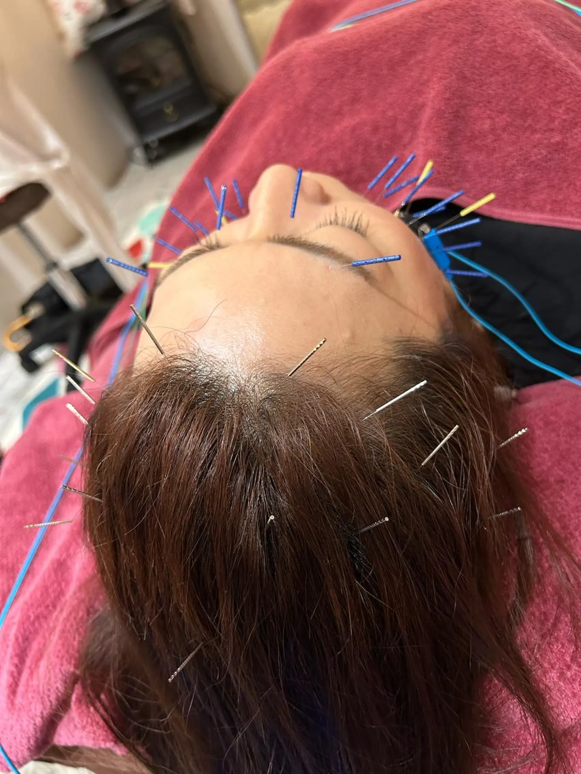 エステ リラク 美容鍼灸女性専用 りんご鍼灸治療院のその他イメージ