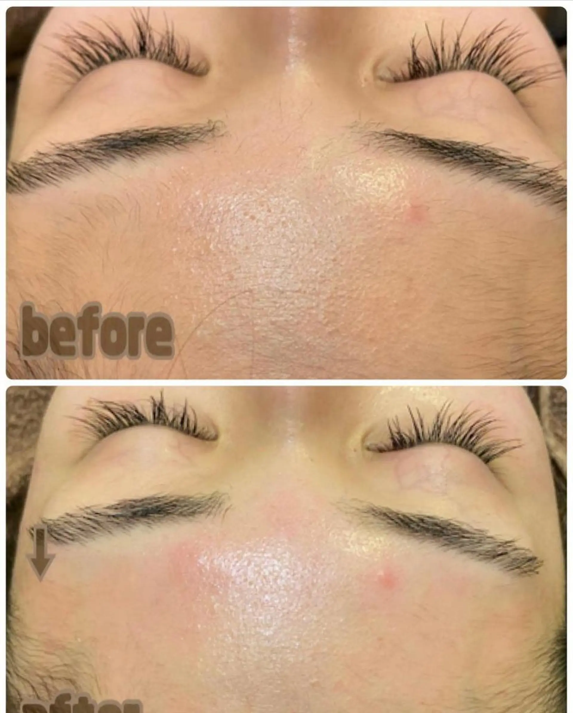 aroma  YURARI所属・韓国艶美人// 毛穴ケア🌹のエステ・リラクイメージ