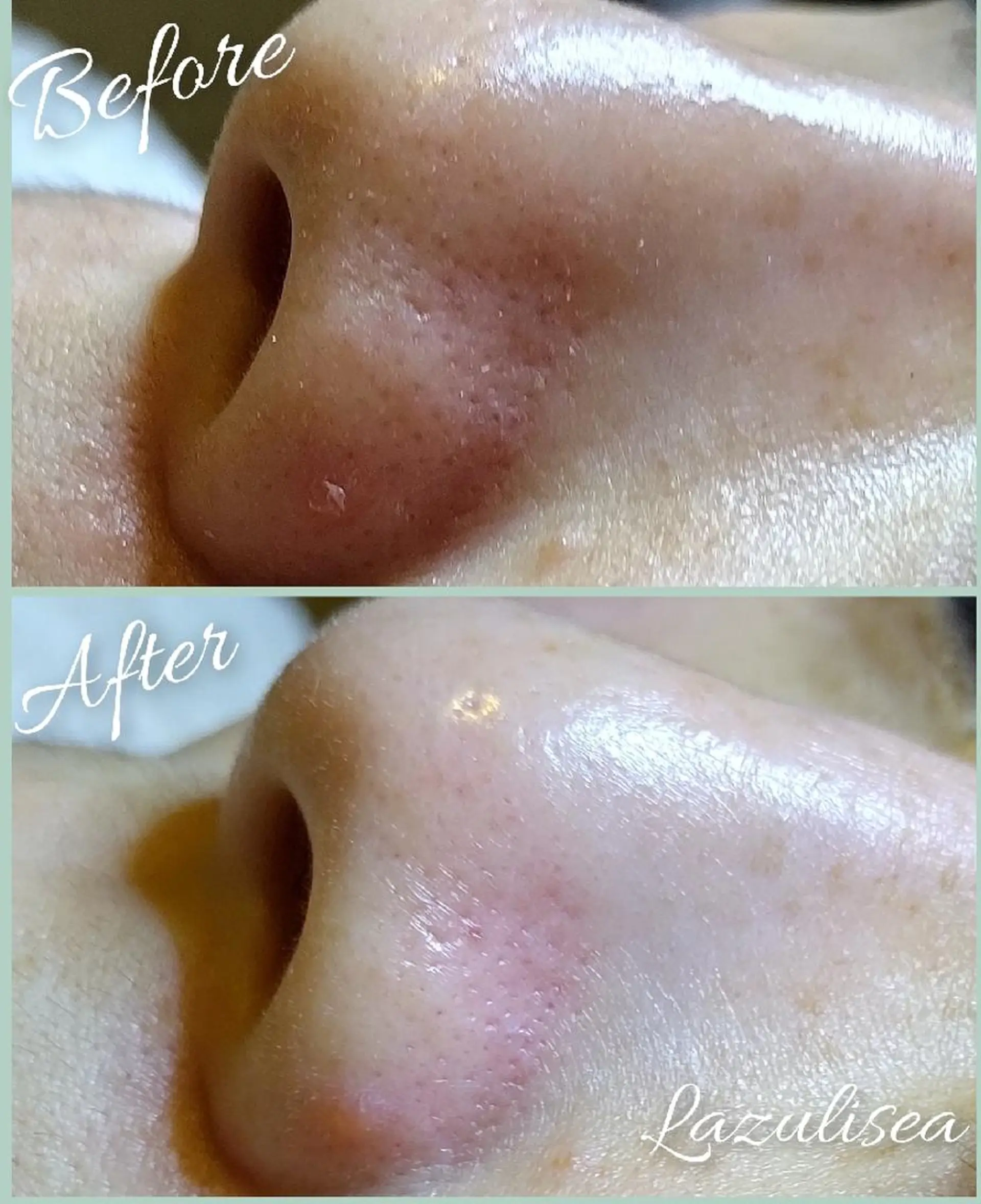 エステ エステサロン　Lazulisea所属・川口 春奈のエステ・リラクイメージ