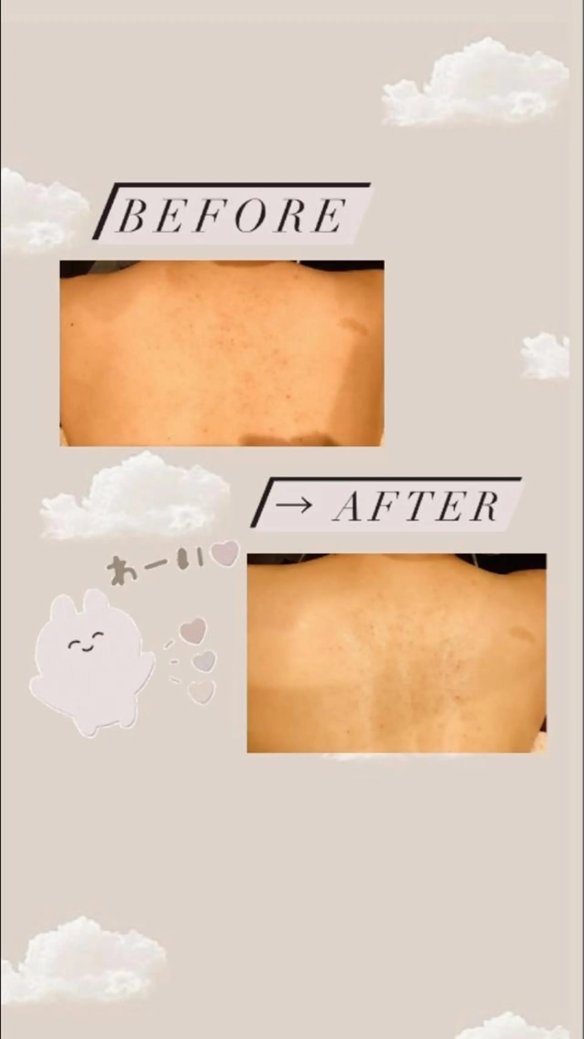 美肌脱毛専門サロン ULULU名駅店のエステ・リラクイメージ