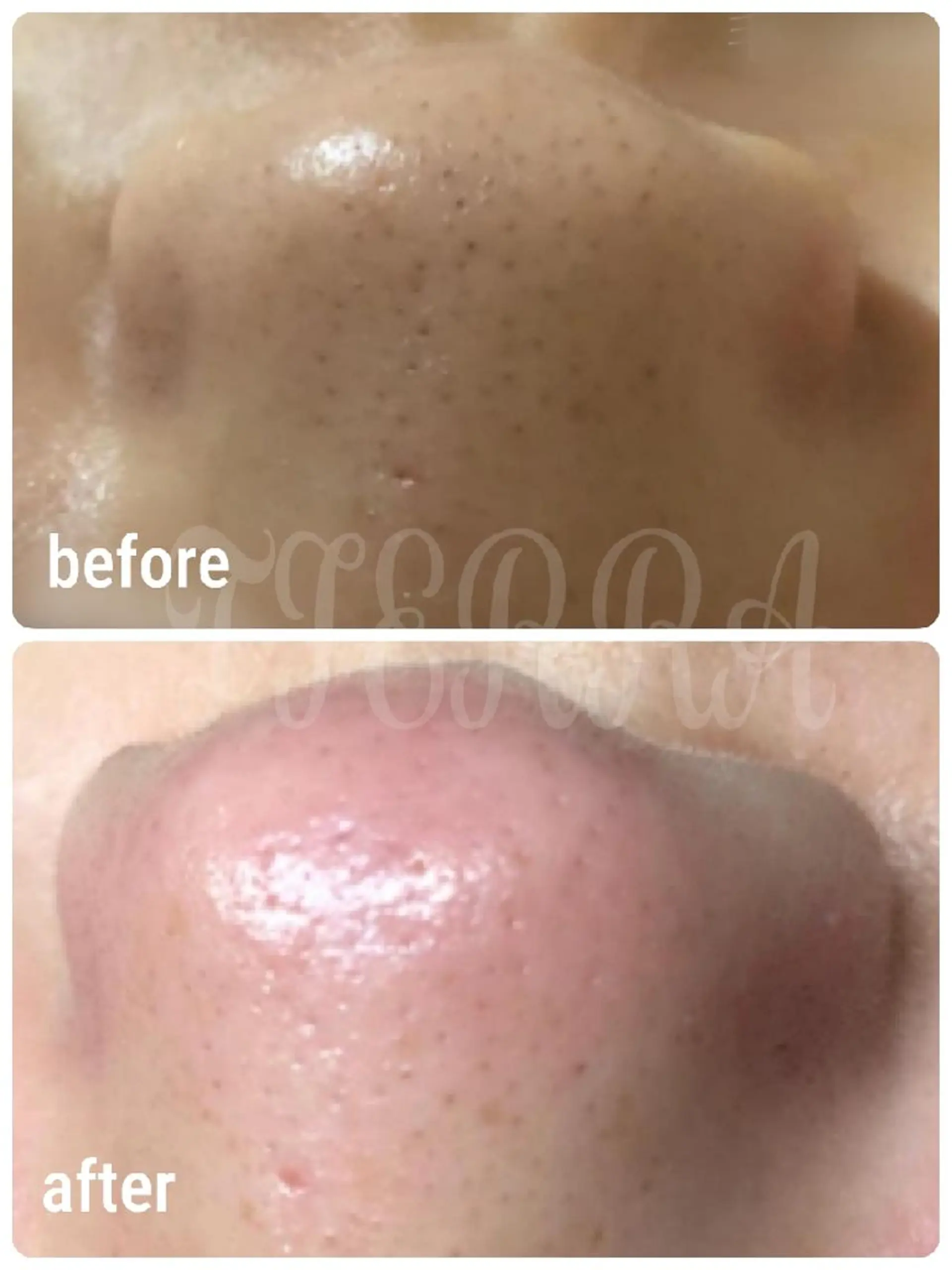 TIERRA(ティエラ)所属・TIERRA ♡のエステ・リラクイメージ