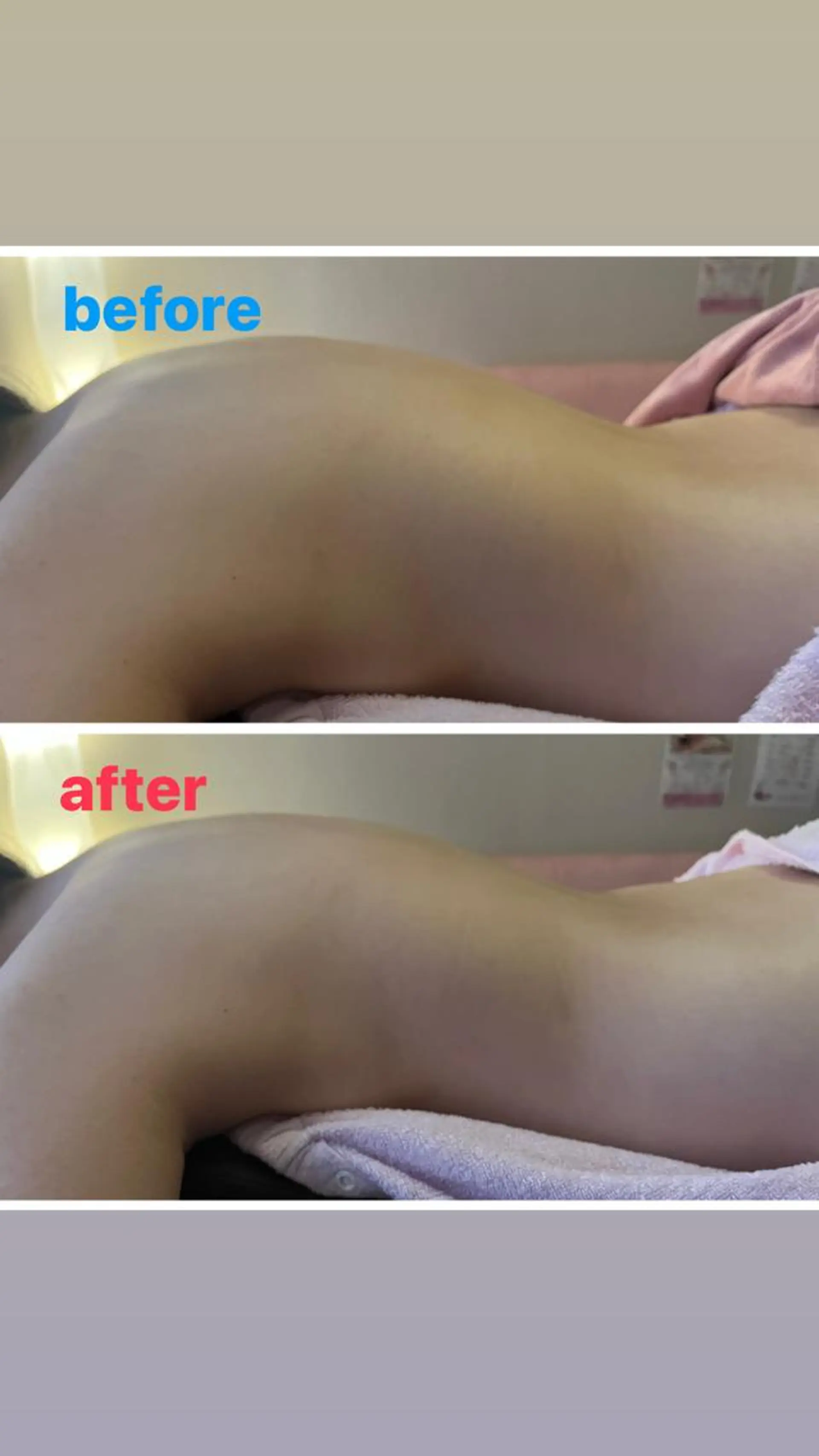 アロマ･美容鍼･カッ ピング「麗」鍼灸院のエステ・リラクイメージ