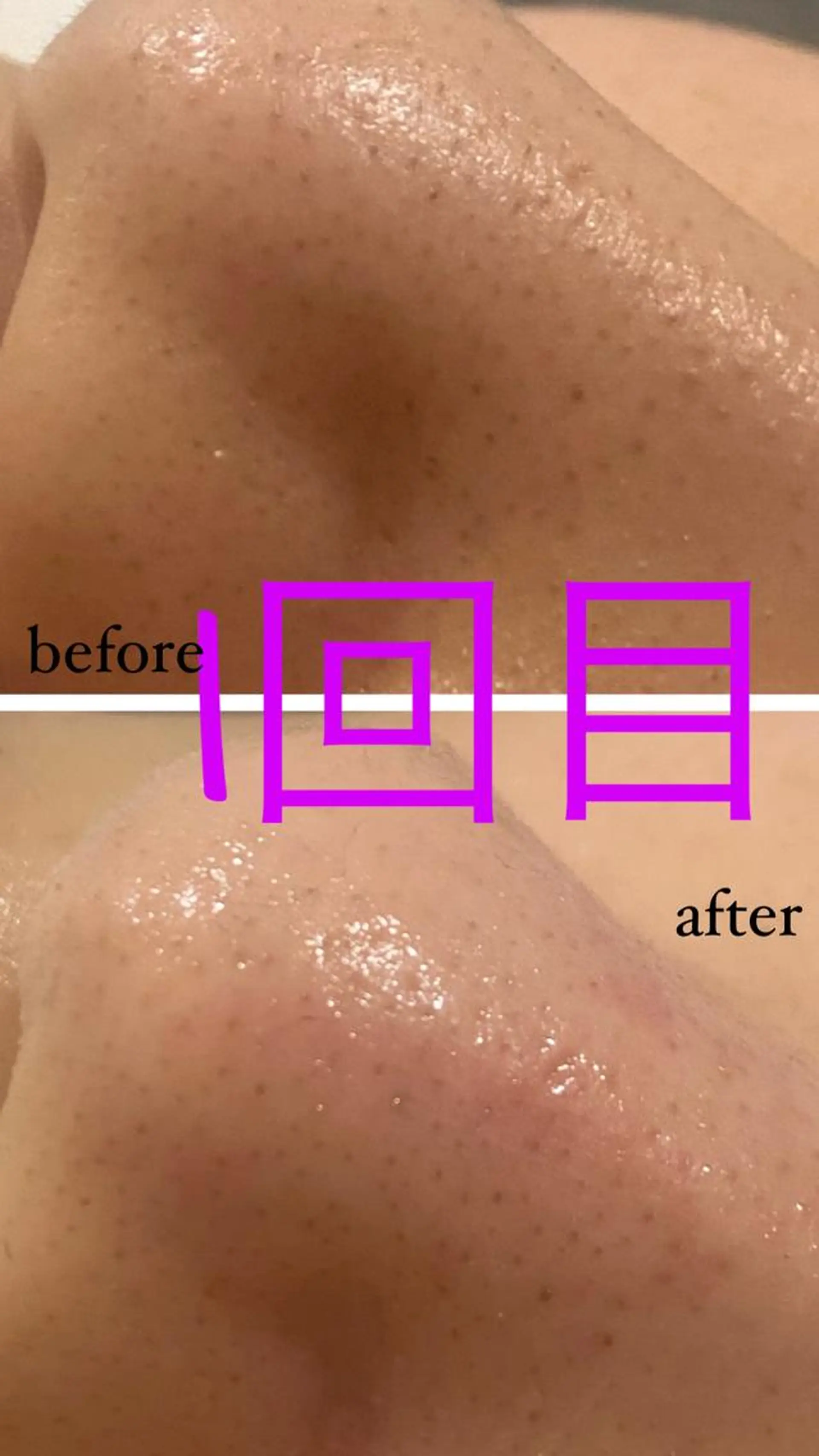 アルカンジュ~archange~所属・痩身/毛穴洗浄/脱毛 アルカンジュのエステ・リラクイメージ