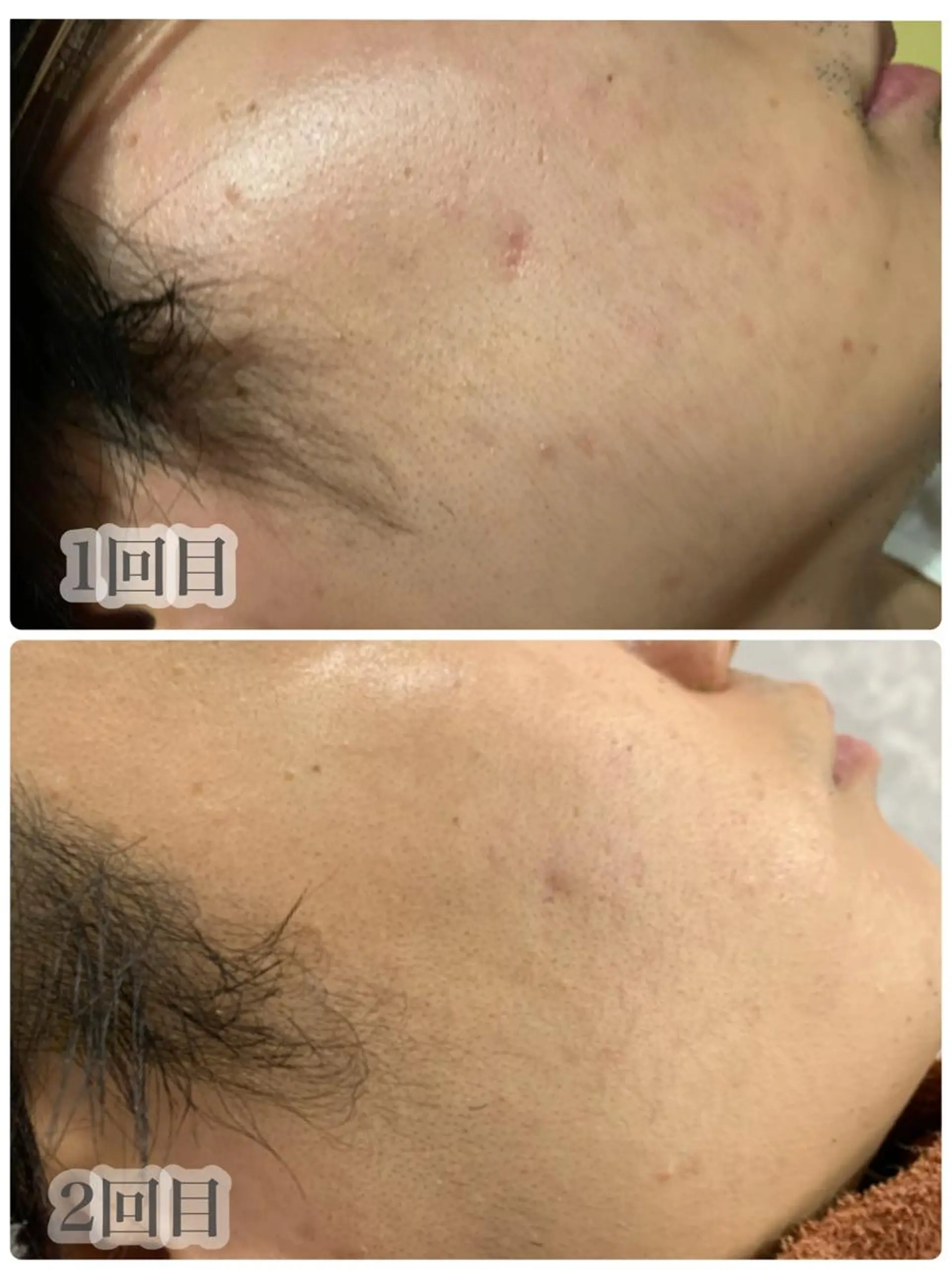 LAGRECE 大阪梅田店のエステ・リラクイメージ