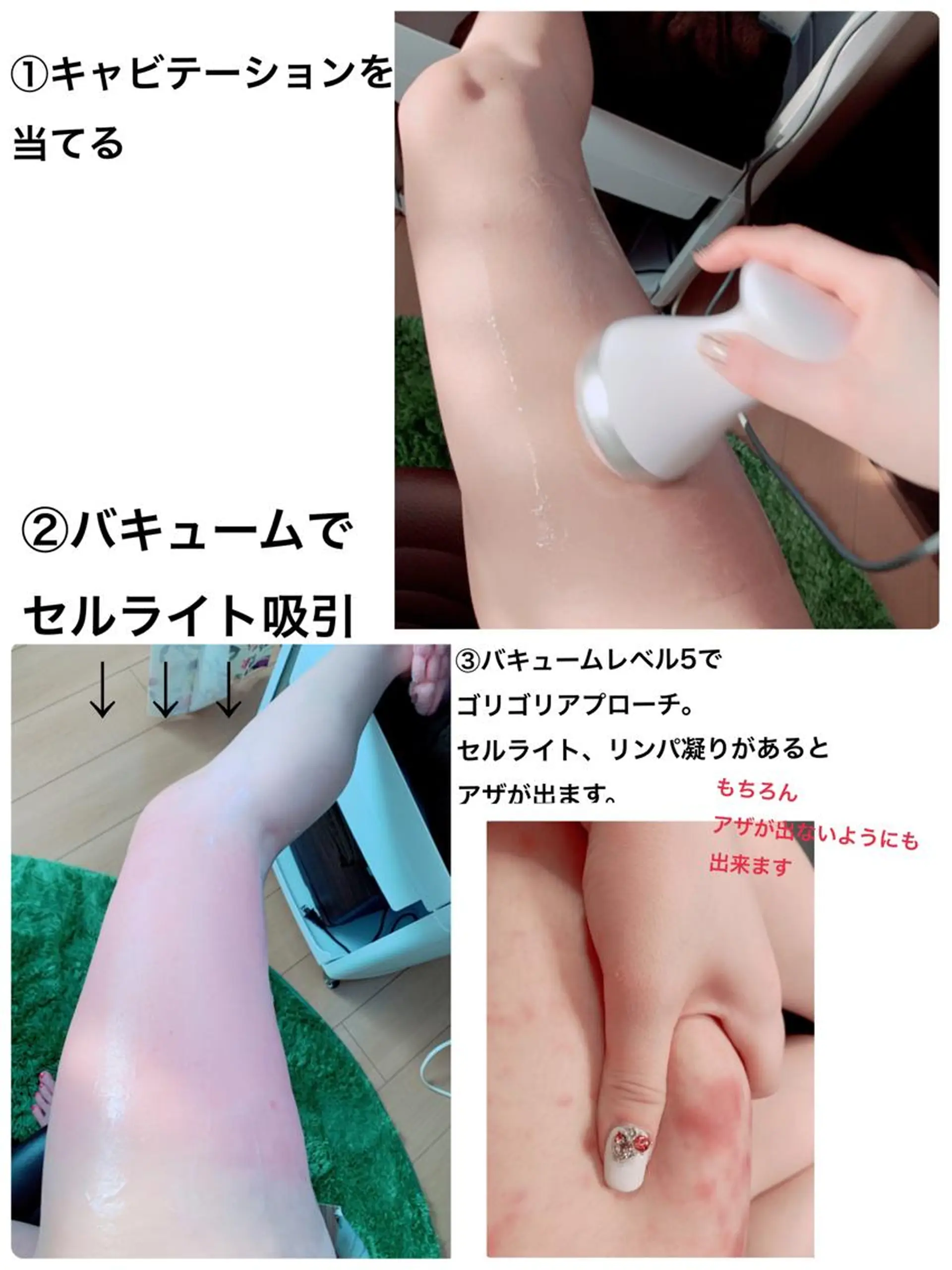 エステ リラク 痩身/脱毛/ネイル HARUKAのエステ・リラクイメージ