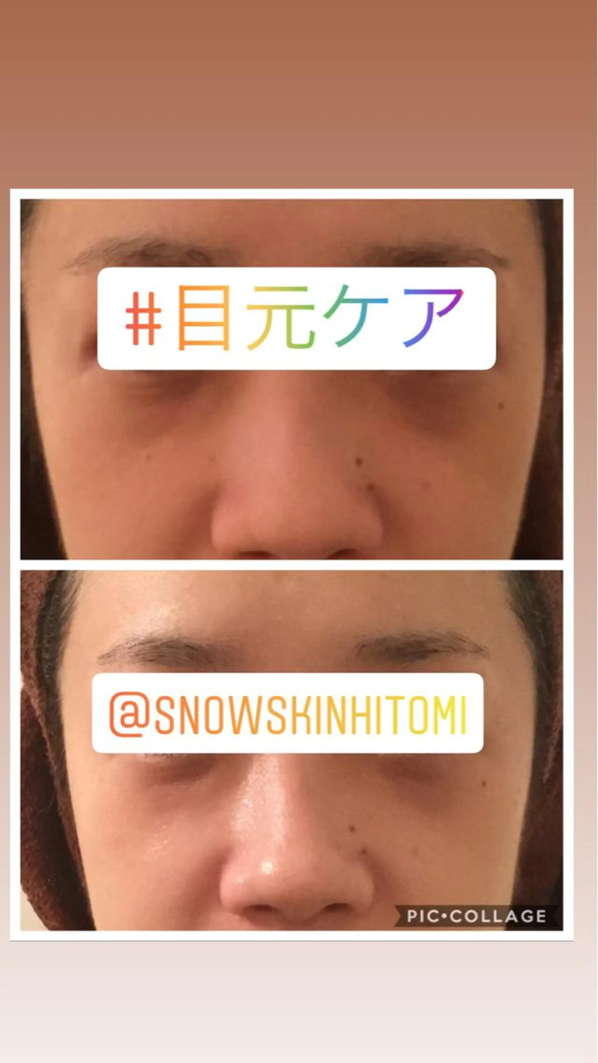 エステ リラク ニキビ/肌質改善専門 Snow skinのエステ・リラクイメージ