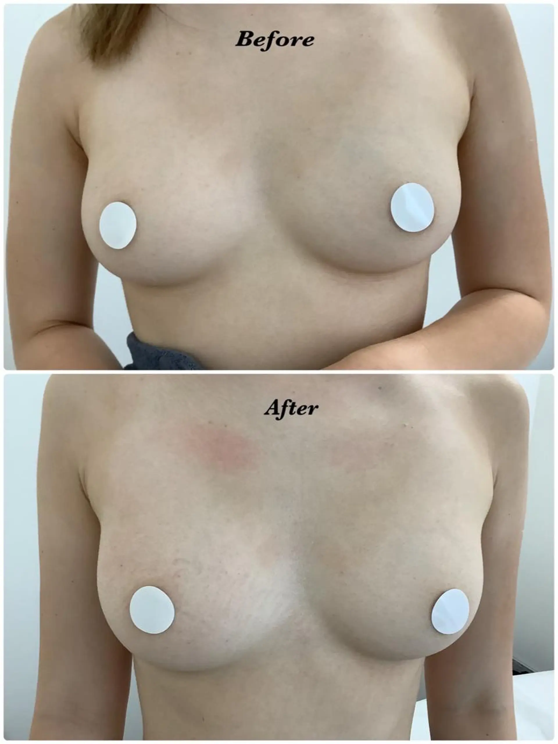 🩵Tatsumi Kana🩵のエステ・リラクイメージ