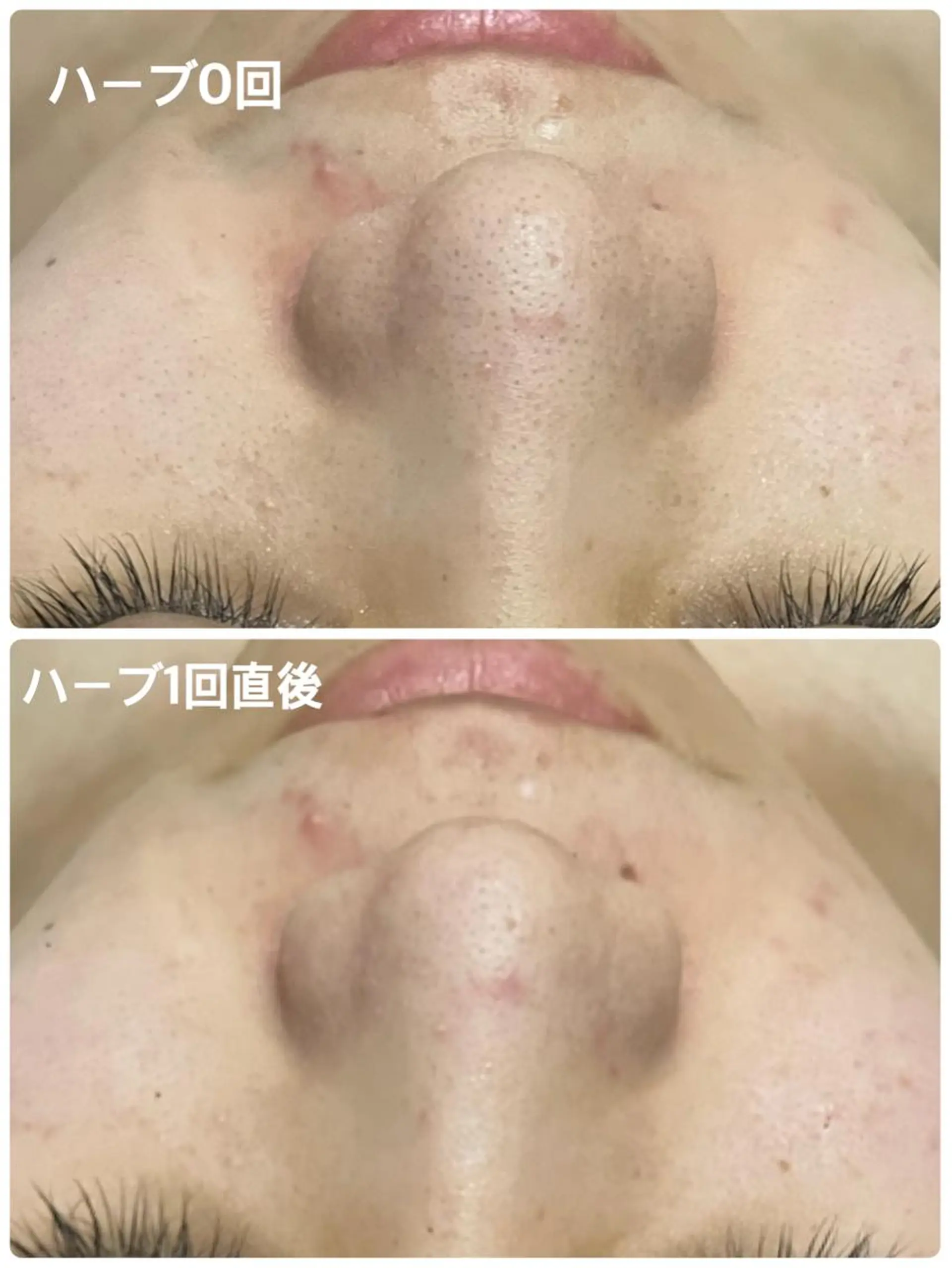 エステ SALON BioBioのエステ・リラクイメージ