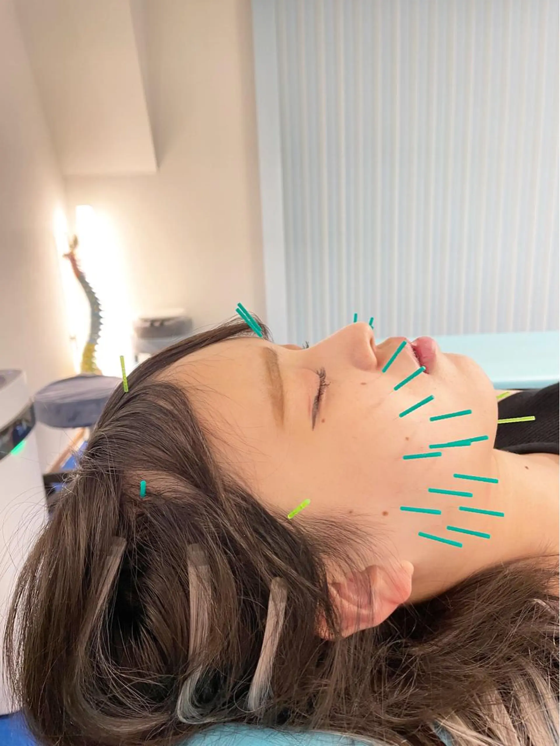 エステ リラク 小顔美容鍼専門サロン 渋谷YZのその他イメージ