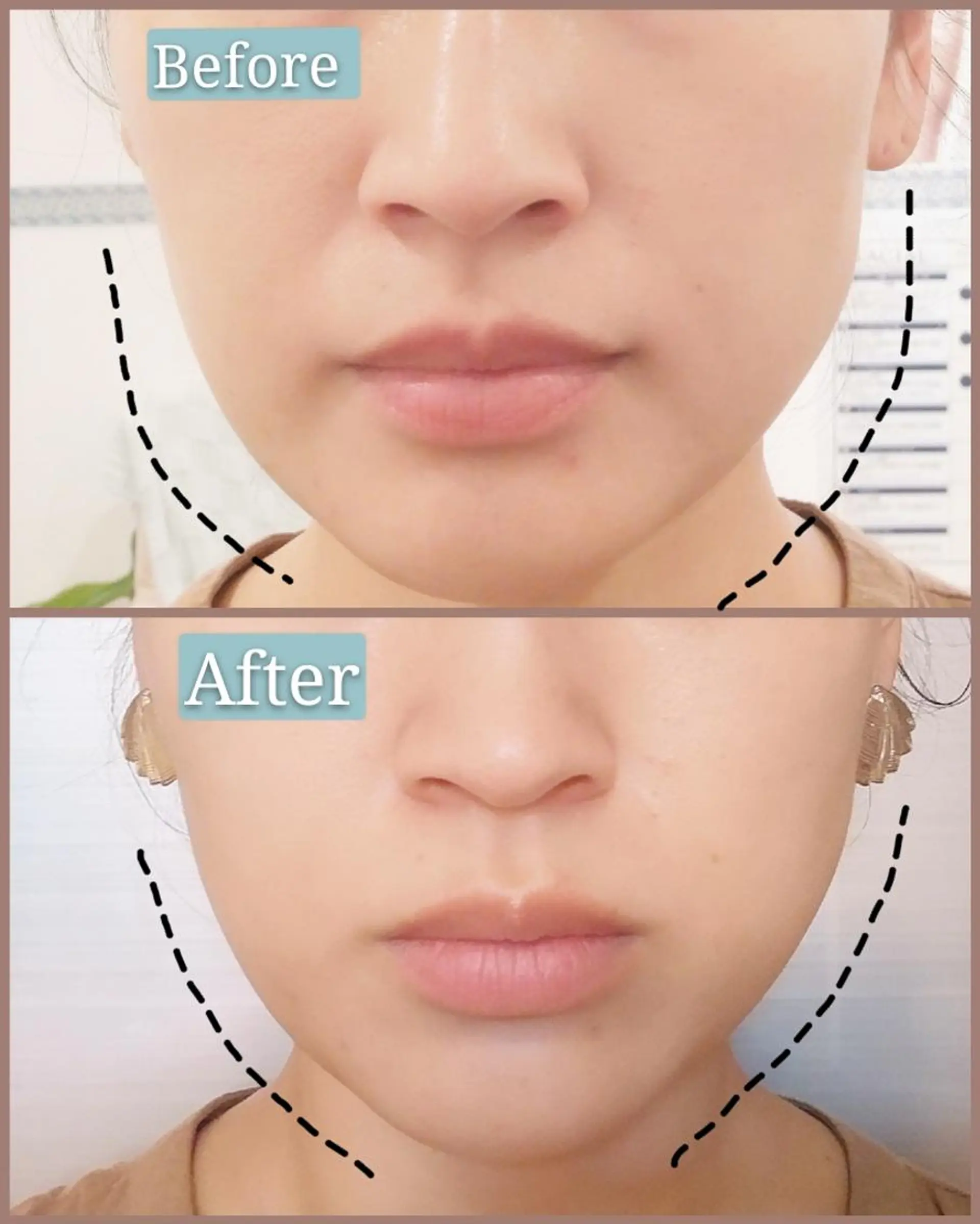 🅖🅤🅩🅔🅛 salonのエステ・リラクイメージ