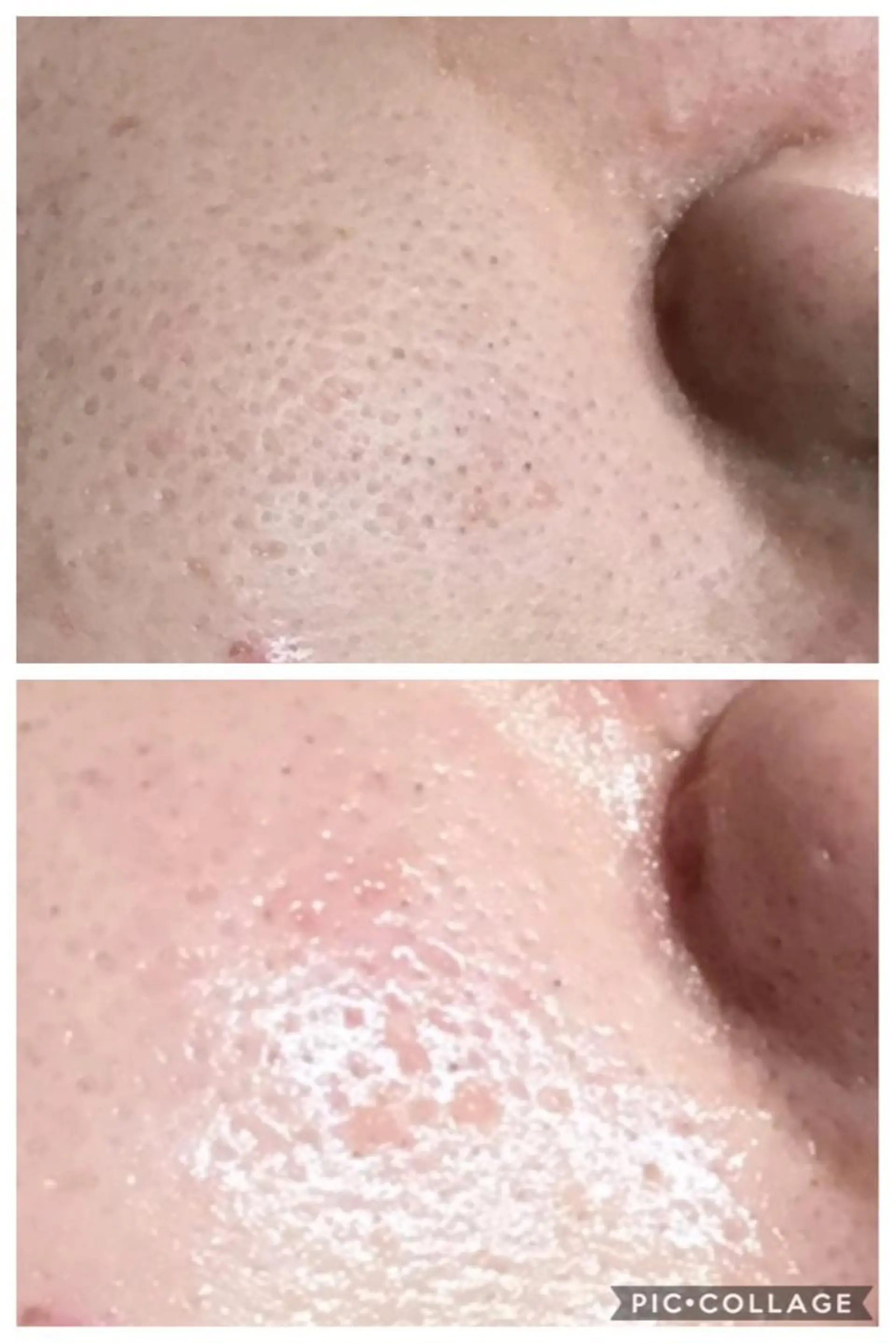 ニキビ/肌質改善専門 Snow skinのエステ・リラクイメージ