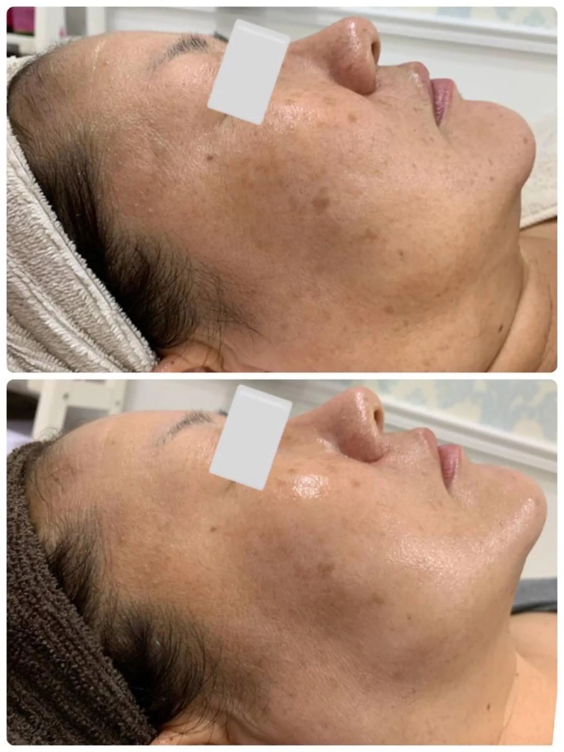 Lumiere despoir所属・Lumiere despoirのエステ・リラクイメージ