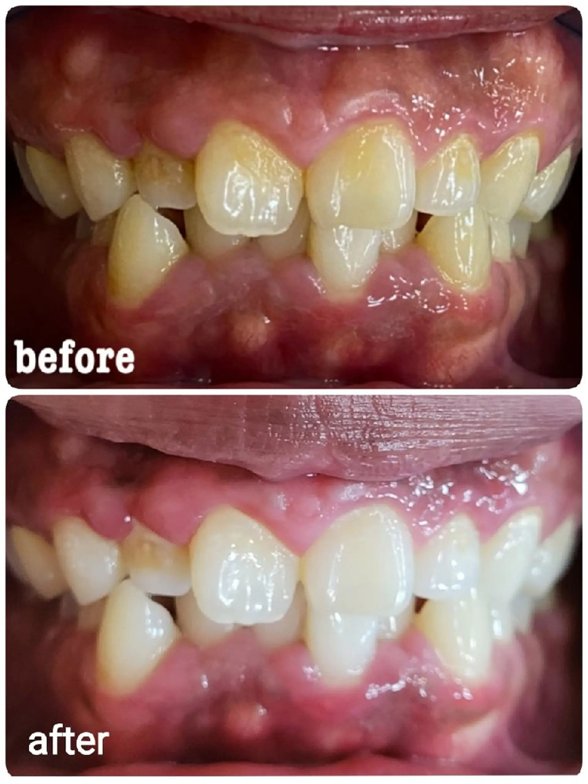 ホワイトニングサロン ラウレアのその他イメージ