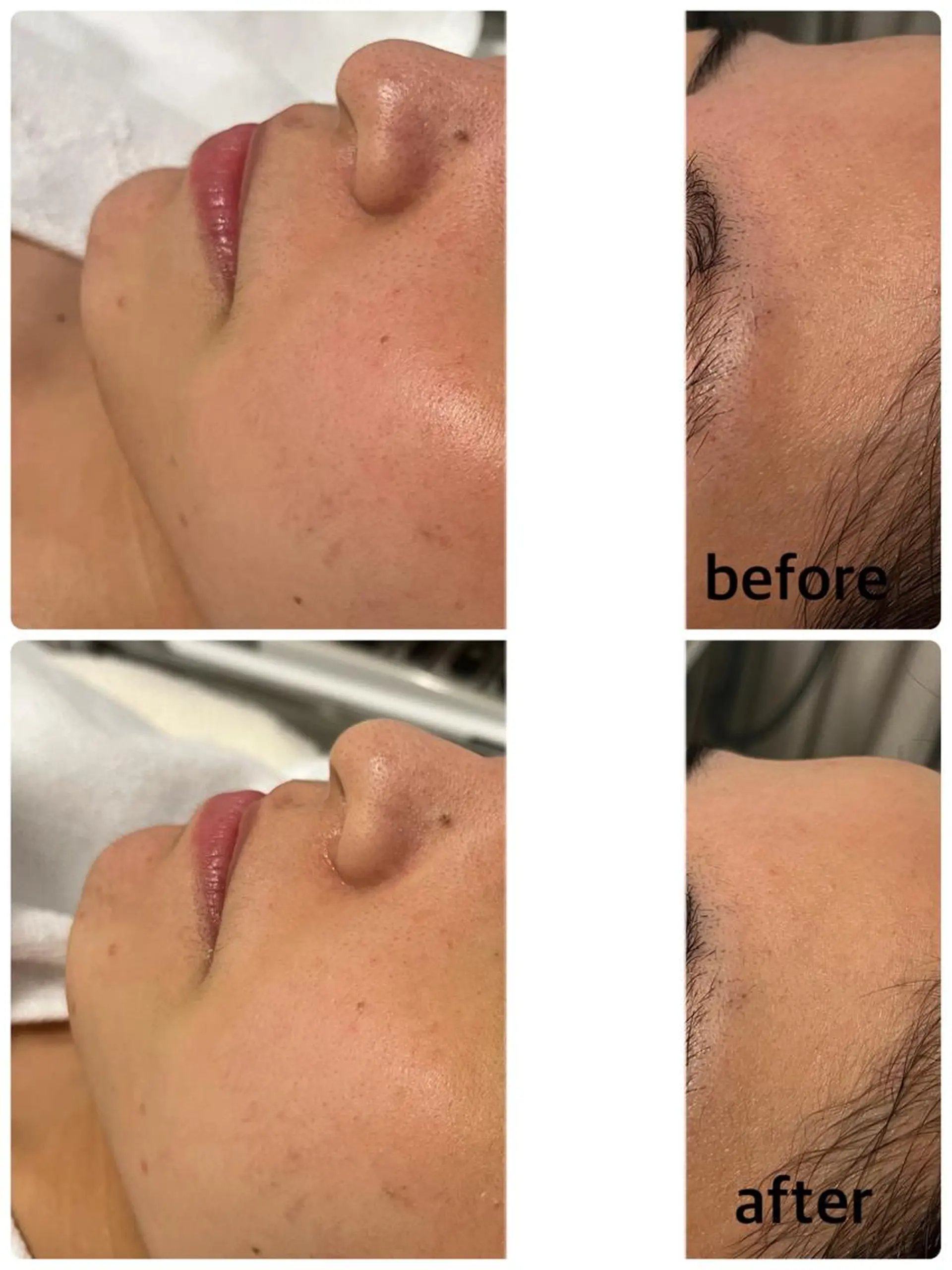 エステ 肌育成サロンcoco.A(ココアンジュ)所属・美肌コンサルタント/ 小西晴日のエステ・リラクイメージ