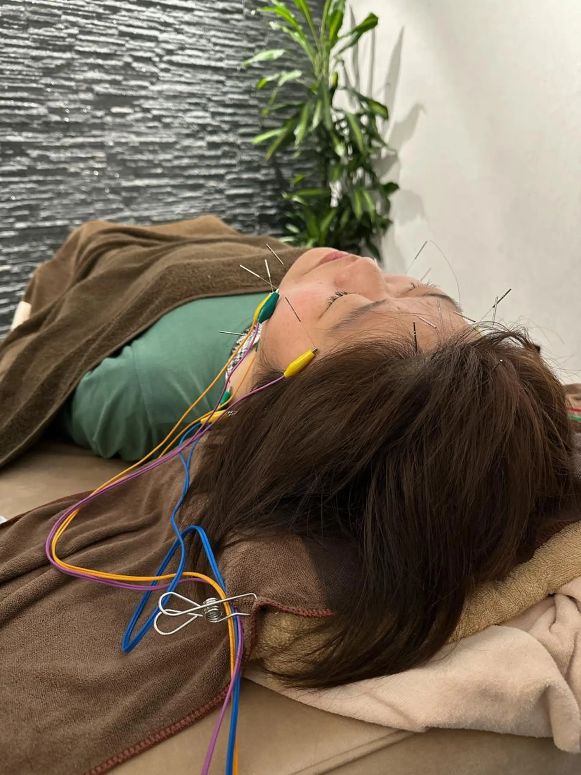 その他 美容鍼灸整体サロンBeauJu所属・小顔矯/美容鍼/鍼灸 BeauJuのその他イメージ