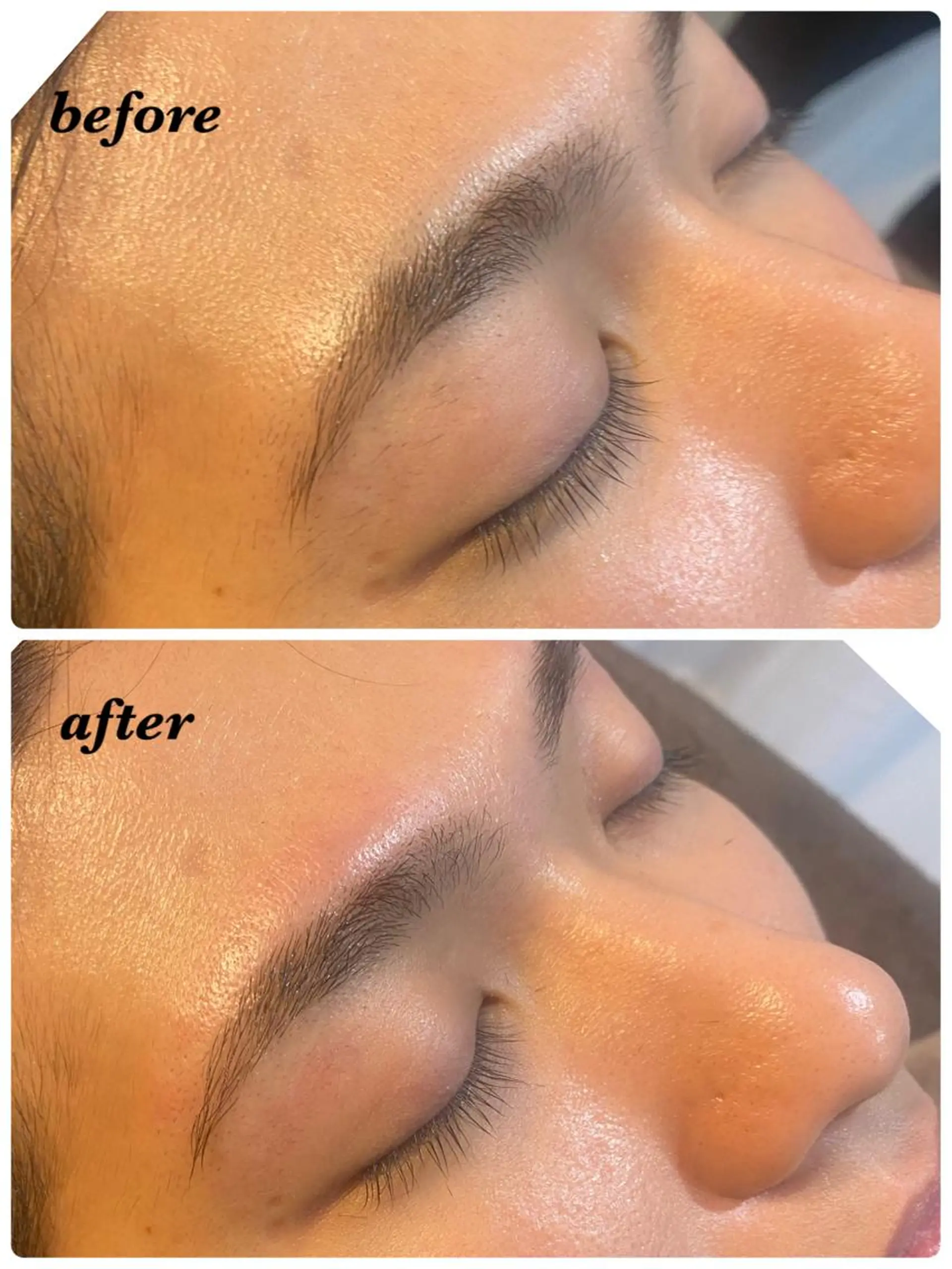 アイブロウ ハーブピーリング/韓国肌管理/フェイシャル/毛穴洗浄/眉毛/顔脱毛【糸脱毛専門】rev所属・ハーブピーリング🌹 毛穴洗浄❤️眉waxのエステ・リラクイメージ