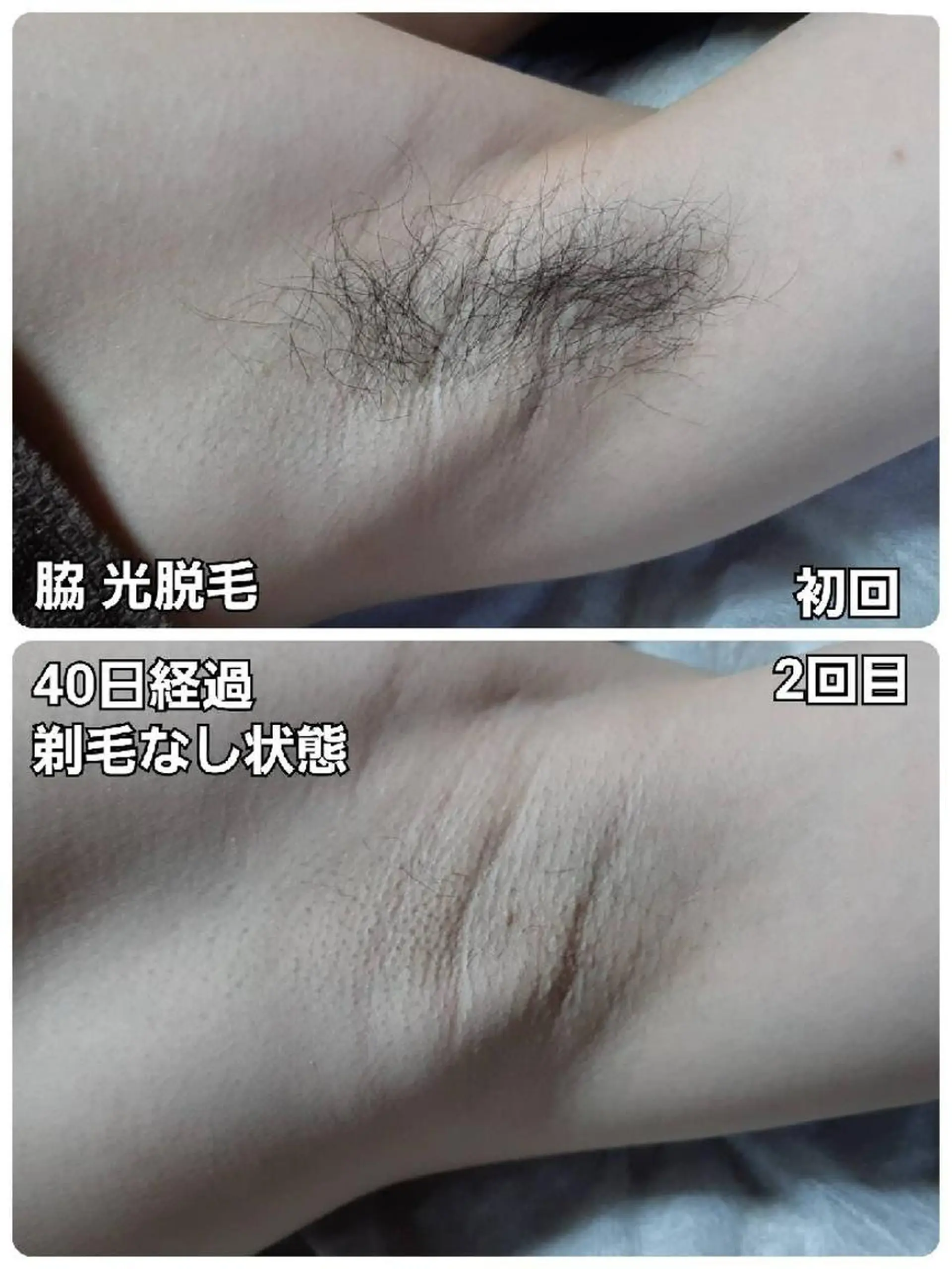 メンズ メンズ・脱毛サロン DEARS所属・山村幸久　メンズ脱毛 ディアーズのエステ・リラクイメージ