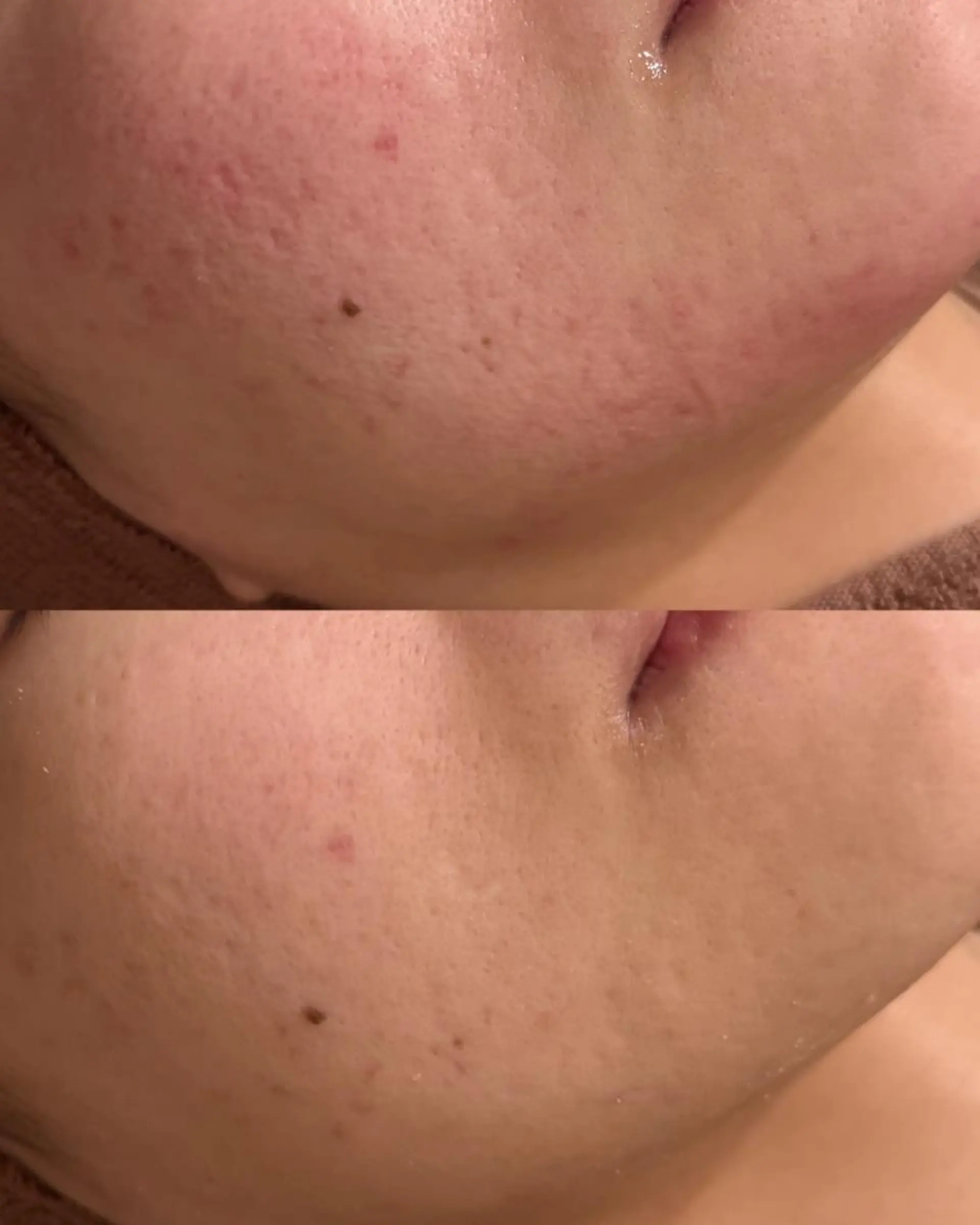 ニキビ・肌質改善専門 ♡人生が変わるサロンのエステ・リラクイメージ