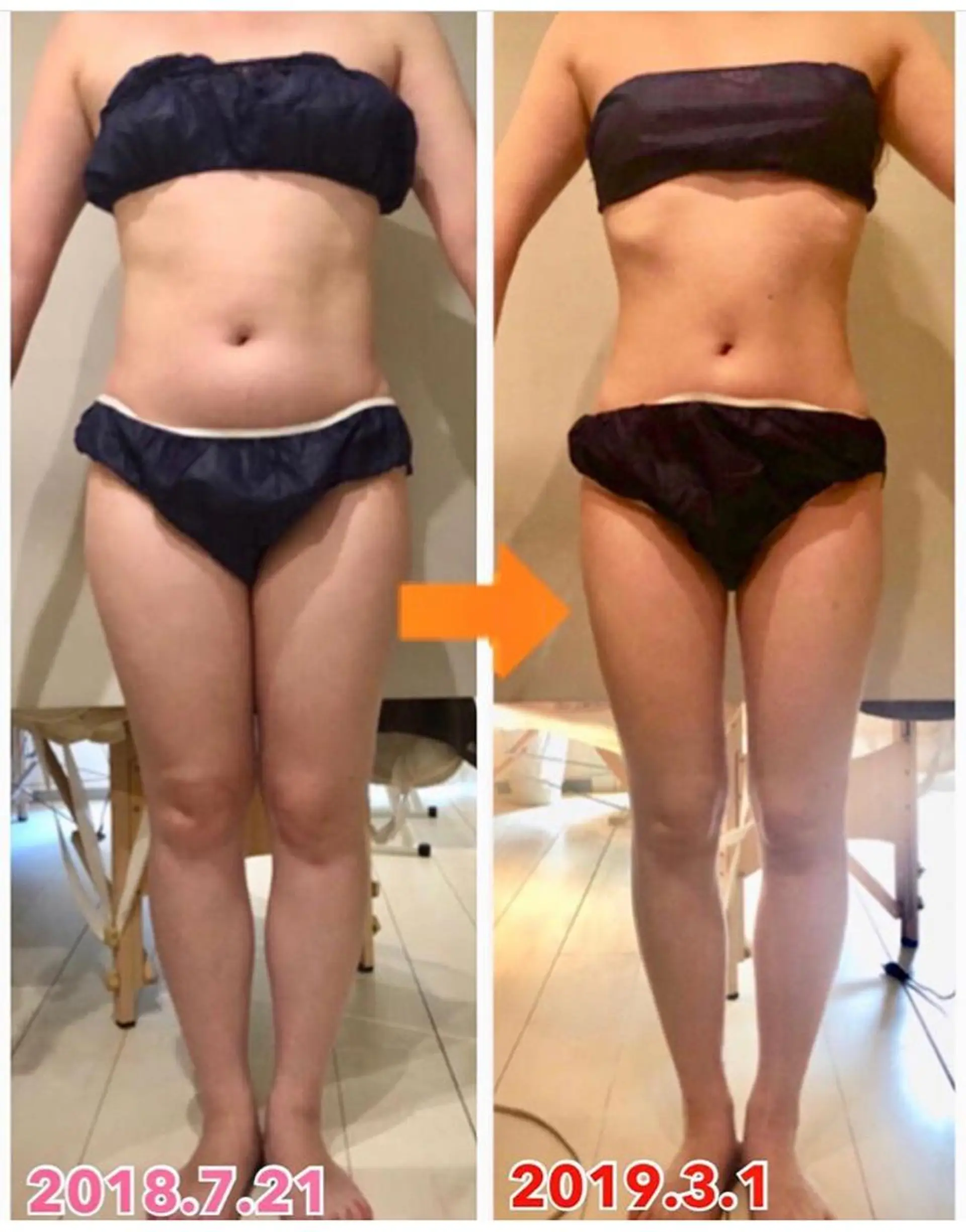 ショート カラー パーマ ヘアアレンジ メンズ キッズ ネイル マツエク・マツパ ‍痩身＆ボディ 結果出し🌟丹野のエステ・リラクイメージ