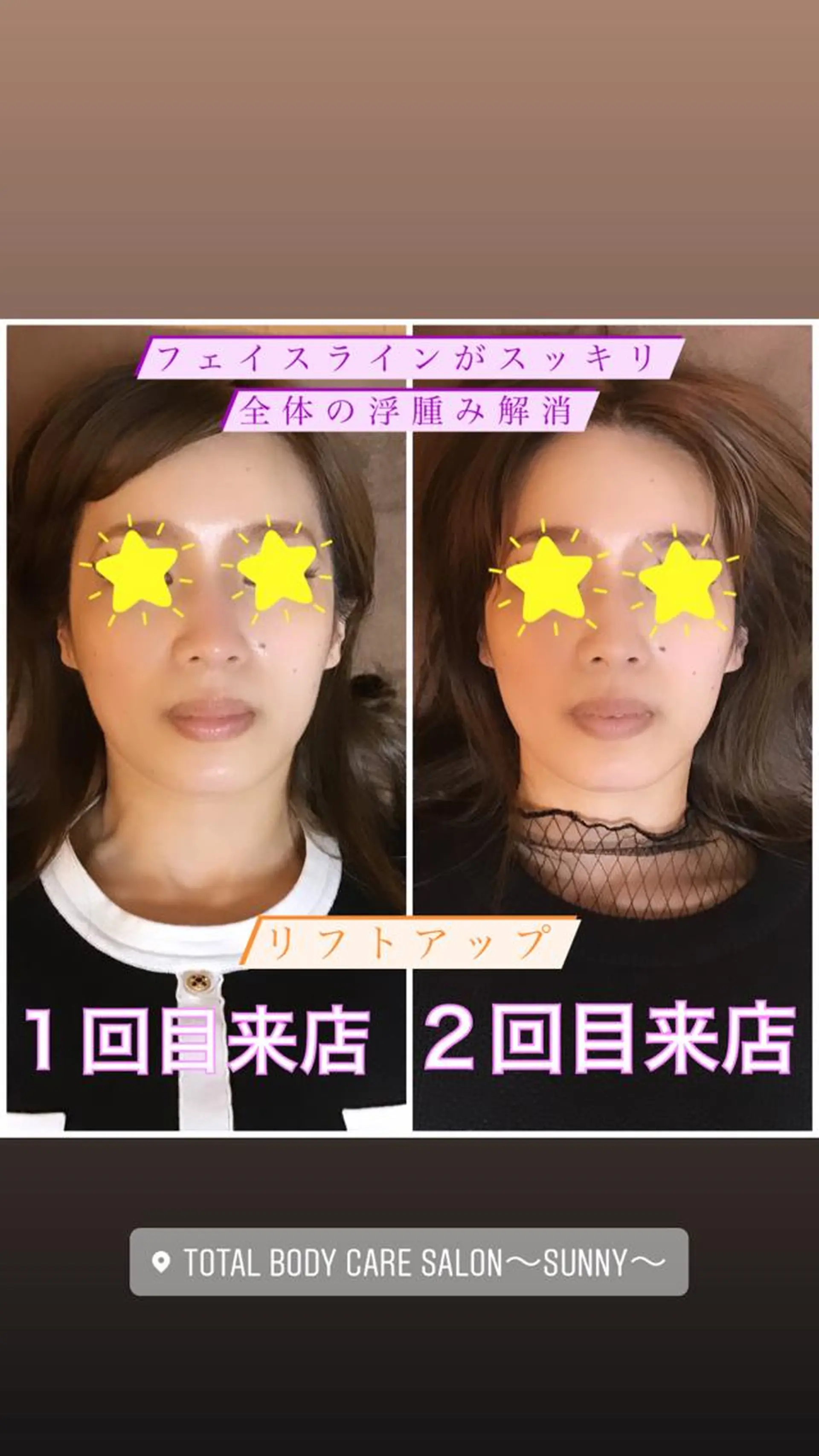 エステ リラク TOTAL BODY CARE SALON SUNNY所属・整体小顔・筋膜オイル ブライダルエステのエステ・リラクイメージ