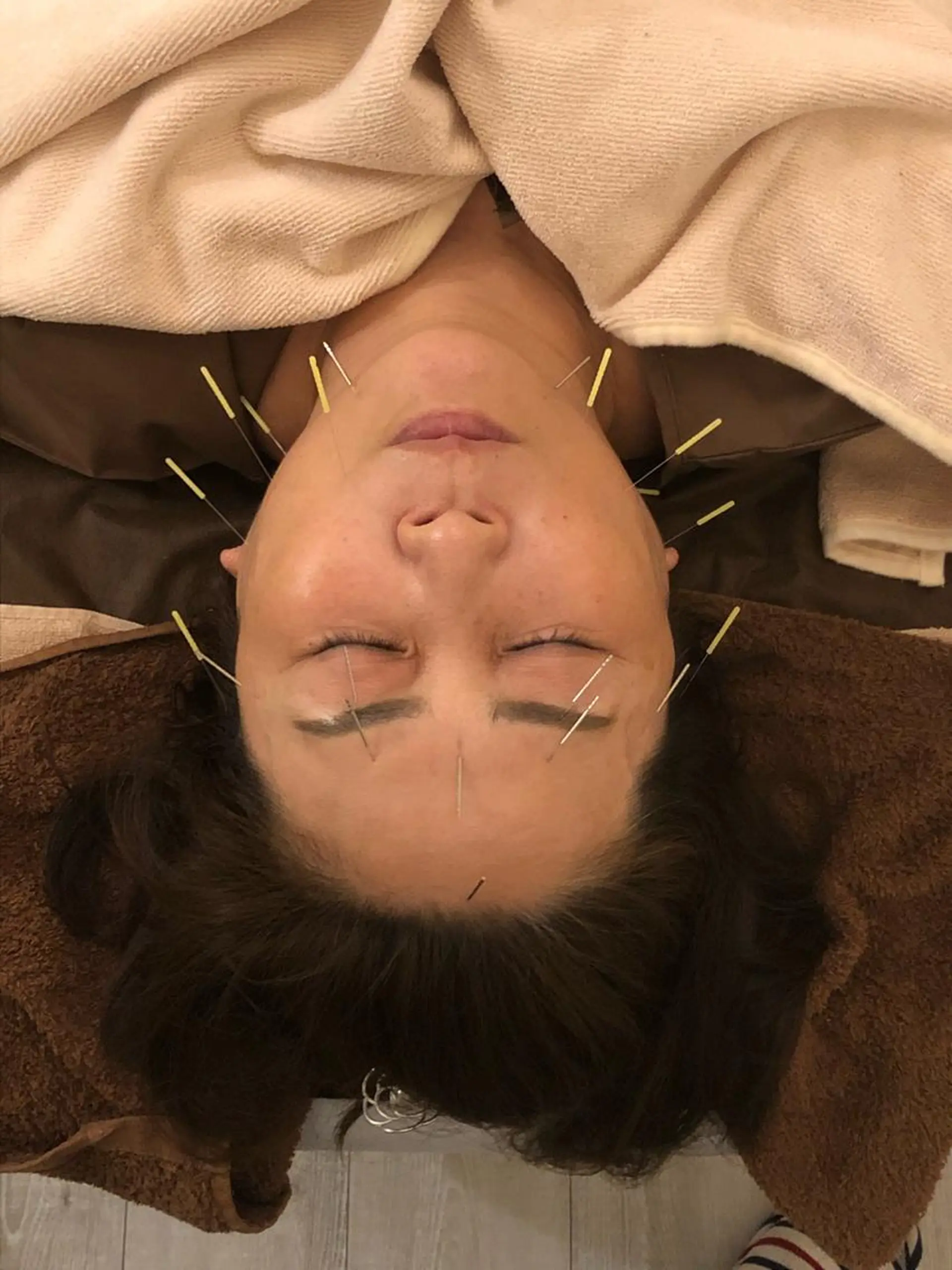 水島 秀輝（美容鍼灸師）のその他イメージ