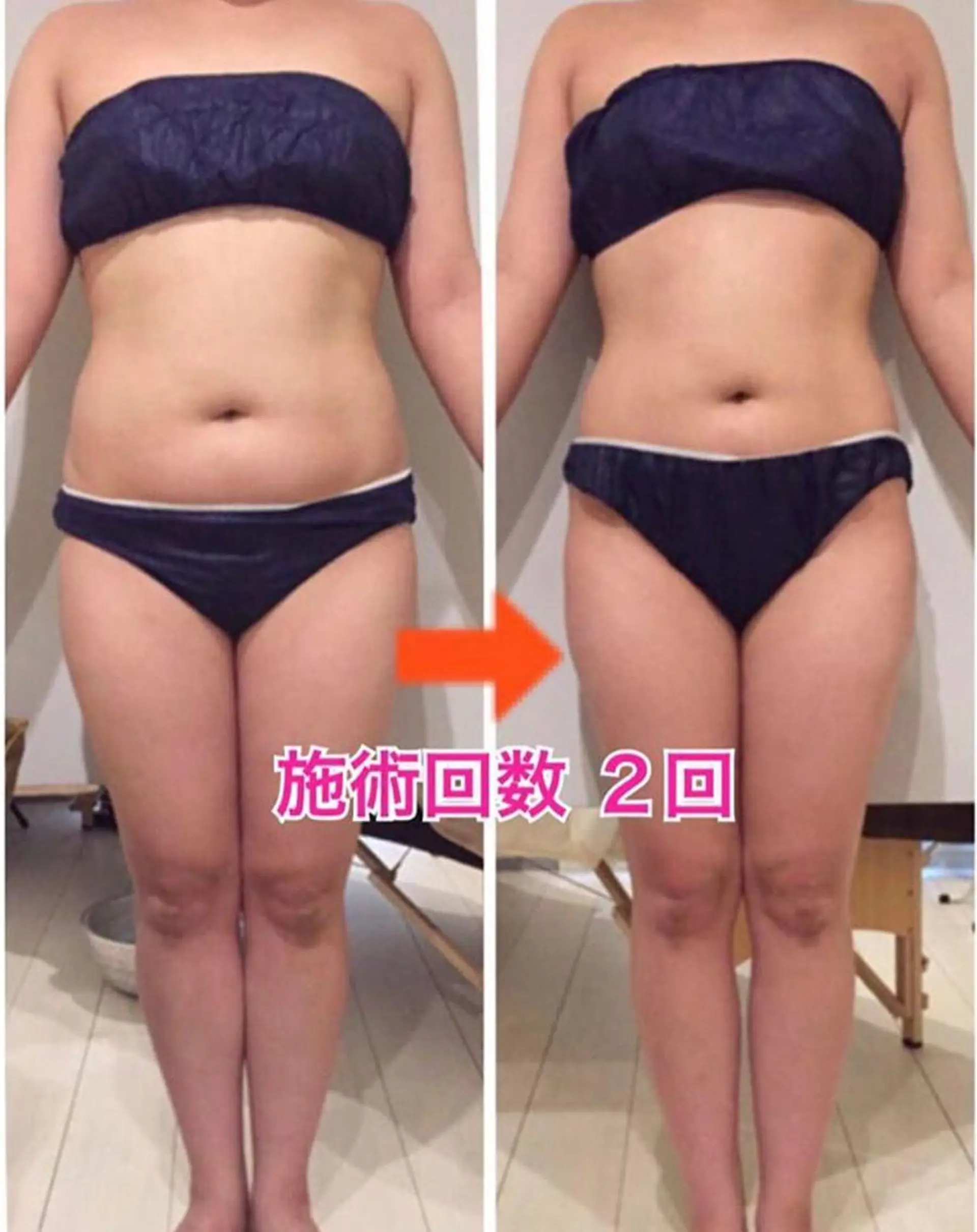 ロング カラー パーマ ヘアアレンジ メンズ キッズ ネイル マツエク・マツパ マットネイル 痩身&ボディ 結果出し🌟丹野のエステ・リラクイメージ