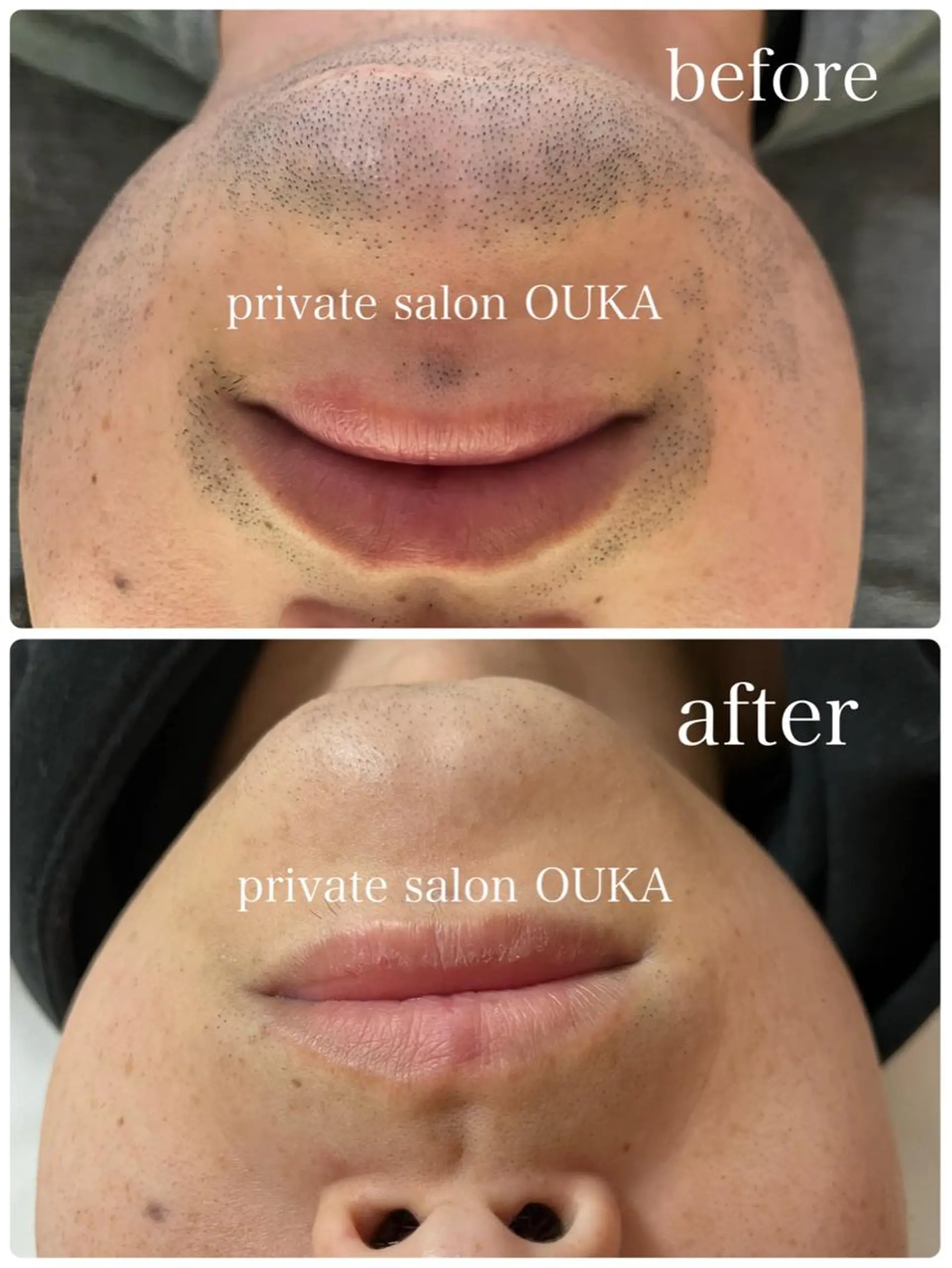 メンズ private salon OUKA所属・OUKA脱毛 毛穴ケアフェイシャルのエステ・リラクイメージ