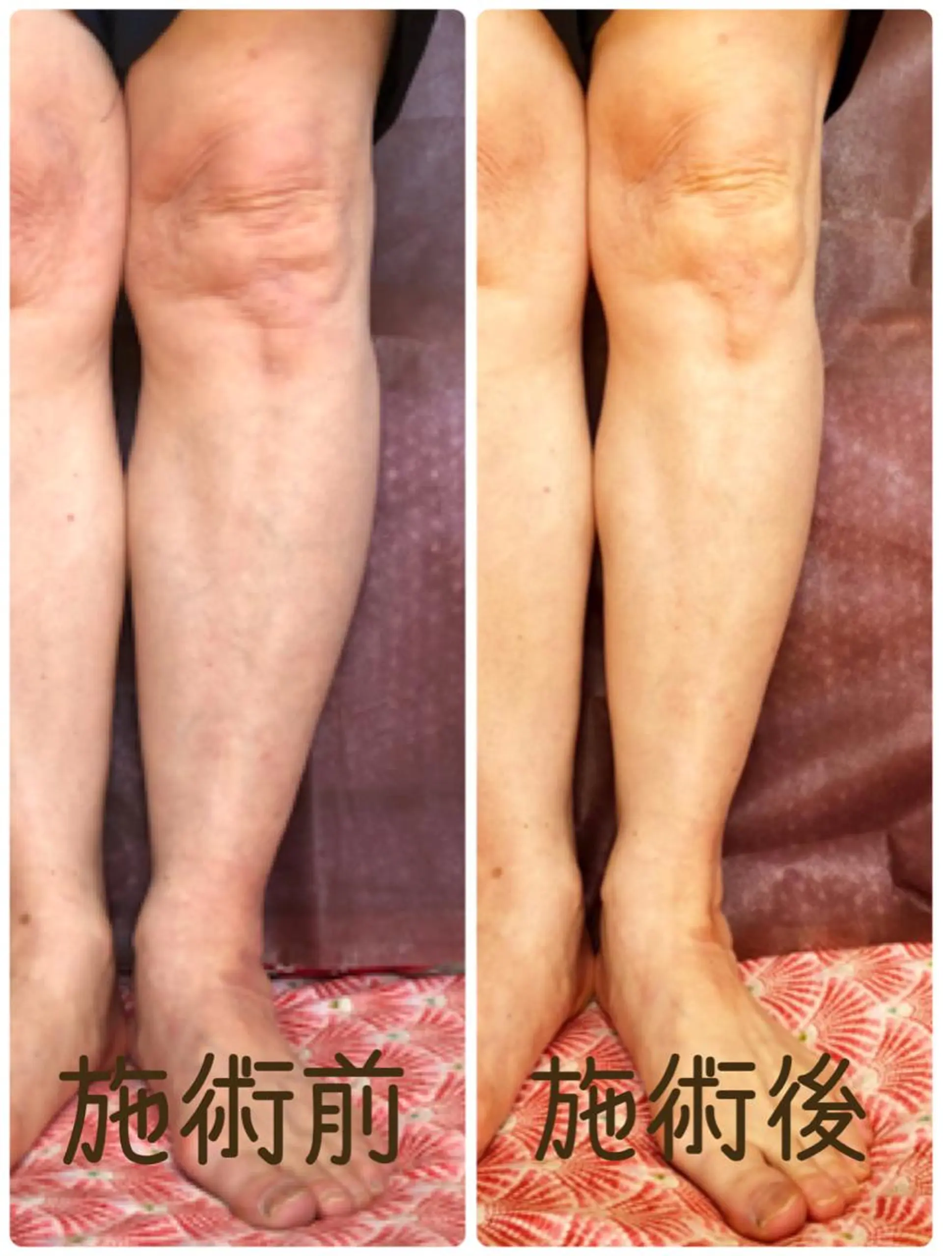 小顔・毛穴・たるみ ネイル　似内真樹のエステ・リラクイメージ